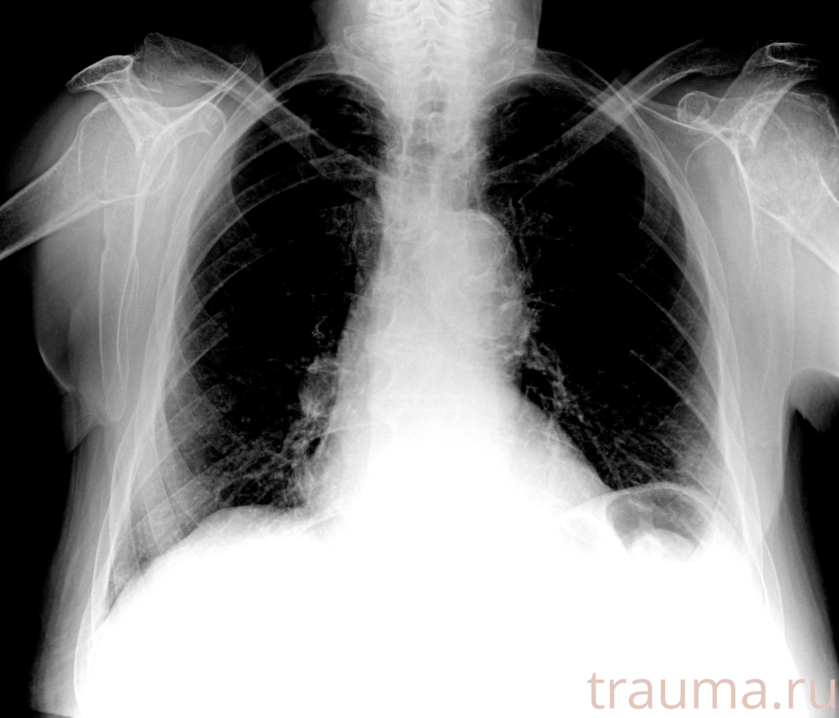 Рентген на дому: по вашему адресу приезжает врач-рентгенолог, травматолог-ортопед с мобильным рентгеновским аппаратом, проводит диагностику травмы или заболевания, делает необходимые рентгенограммы, дает рекомендации по дальнейшему лечению. Получить качественные снимки в домашних условиях возможно благодаря уникальной методике, разработанной МосРентген Центром для института  Склифосовского