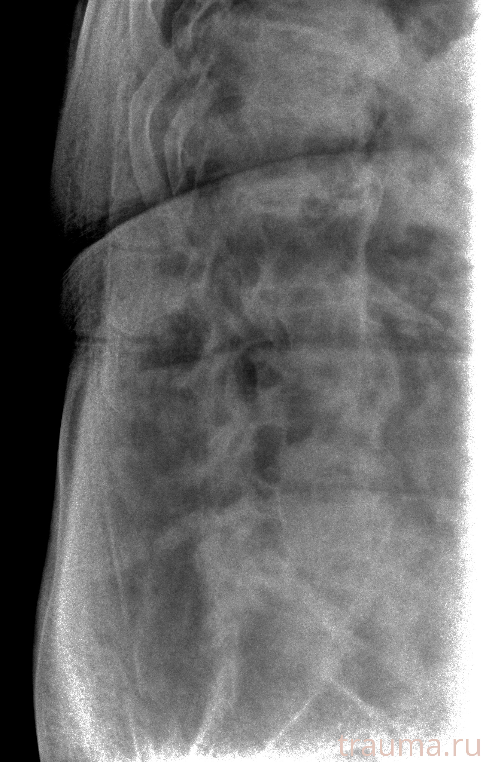 Рентген на дому: по вашему адресу приезжает врач-рентгенолог, травматолог-ортопед с мобильным рентгеновским аппаратом, проводит диагностику травмы или заболевания, делает необходимые рентгенограммы, дает рекомендации по дальнейшему лечению. Получить качественные снимки в домашних условиях возможно благодаря уникальной методике, разработанной МосРентген Центром для института  Склифосовского