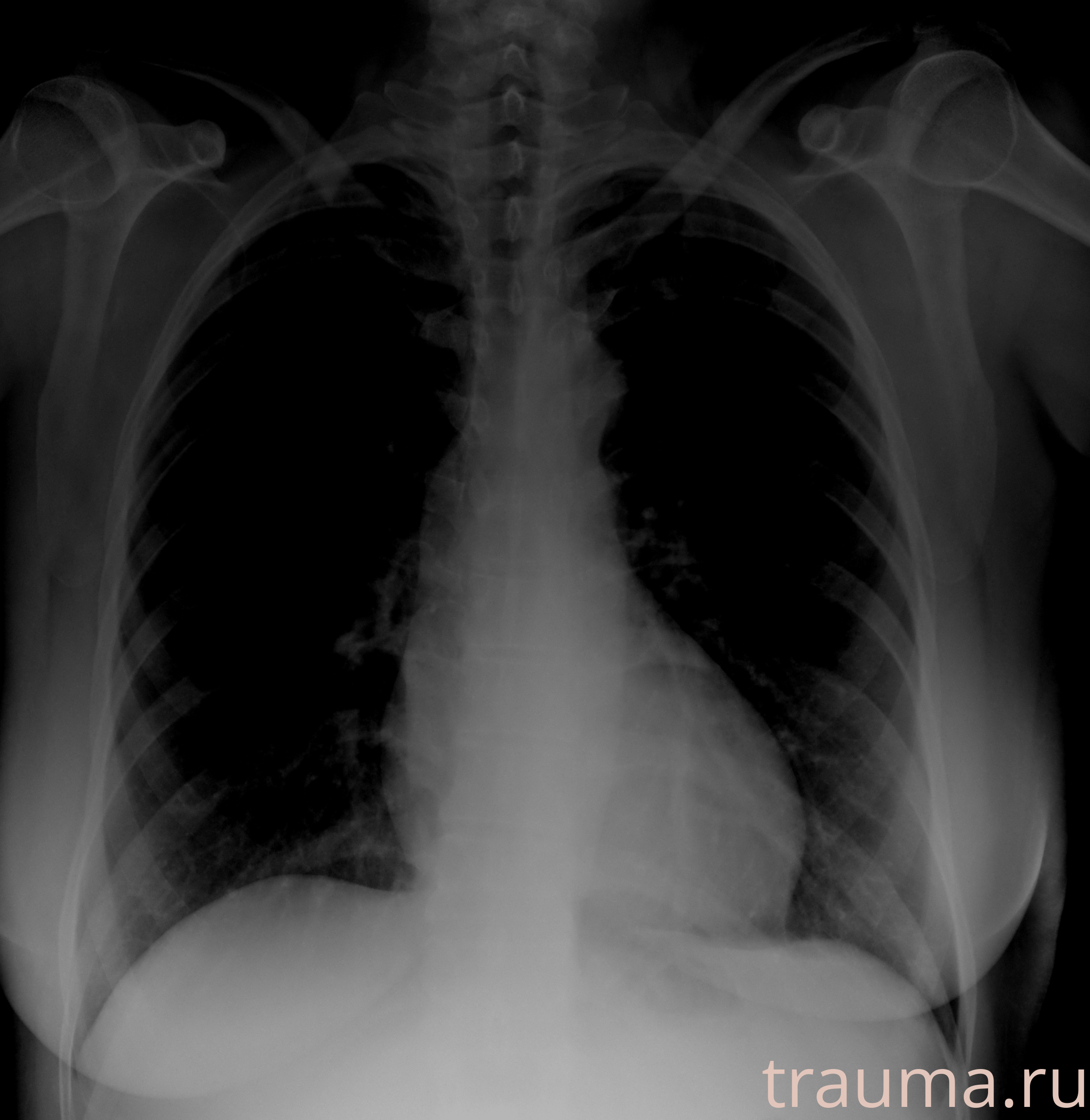 Рентген на дому: по вашему адресу приезжает врач-рентгенолог, травматолог-ортопед с мобильным рентгеновским аппаратом, проводит диагностику травмы или заболевания, делает необходимые рентгенограммы, дает рекомендации по дальнейшему лечению. Получить качественные снимки в домашних условиях возможно благодаря уникальной методике, разработанной МосРентген Центром для института  Склифосовского