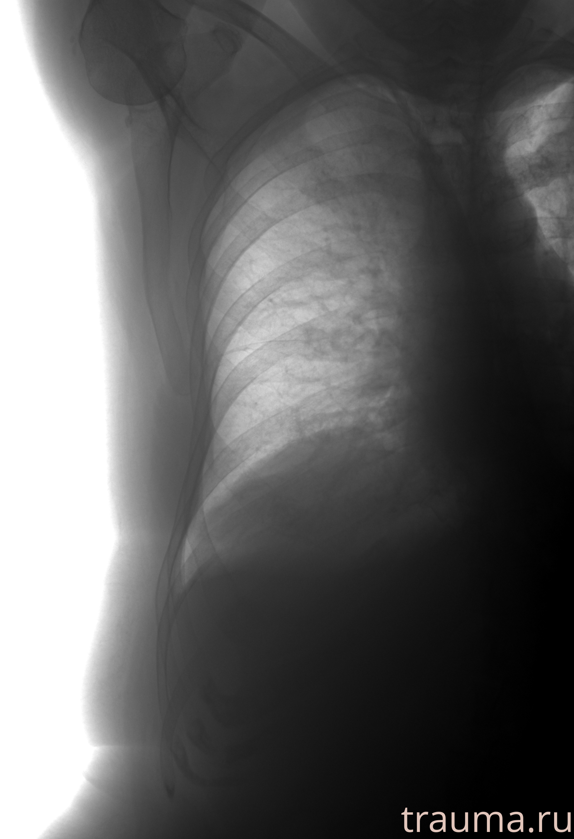 Рентген на дому: по вашему адресу приезжает врач-рентгенолог, травматолог-ортопед с мобильным рентгеновским аппаратом, проводит диагностику травмы или заболевания, делает необходимые рентгенограммы, дает рекомендации по дальнейшему лечению. Получить качественные снимки в домашних условиях возможно благодаря уникальной методике, разработанной МосРентген Центром для института  Склифосовского