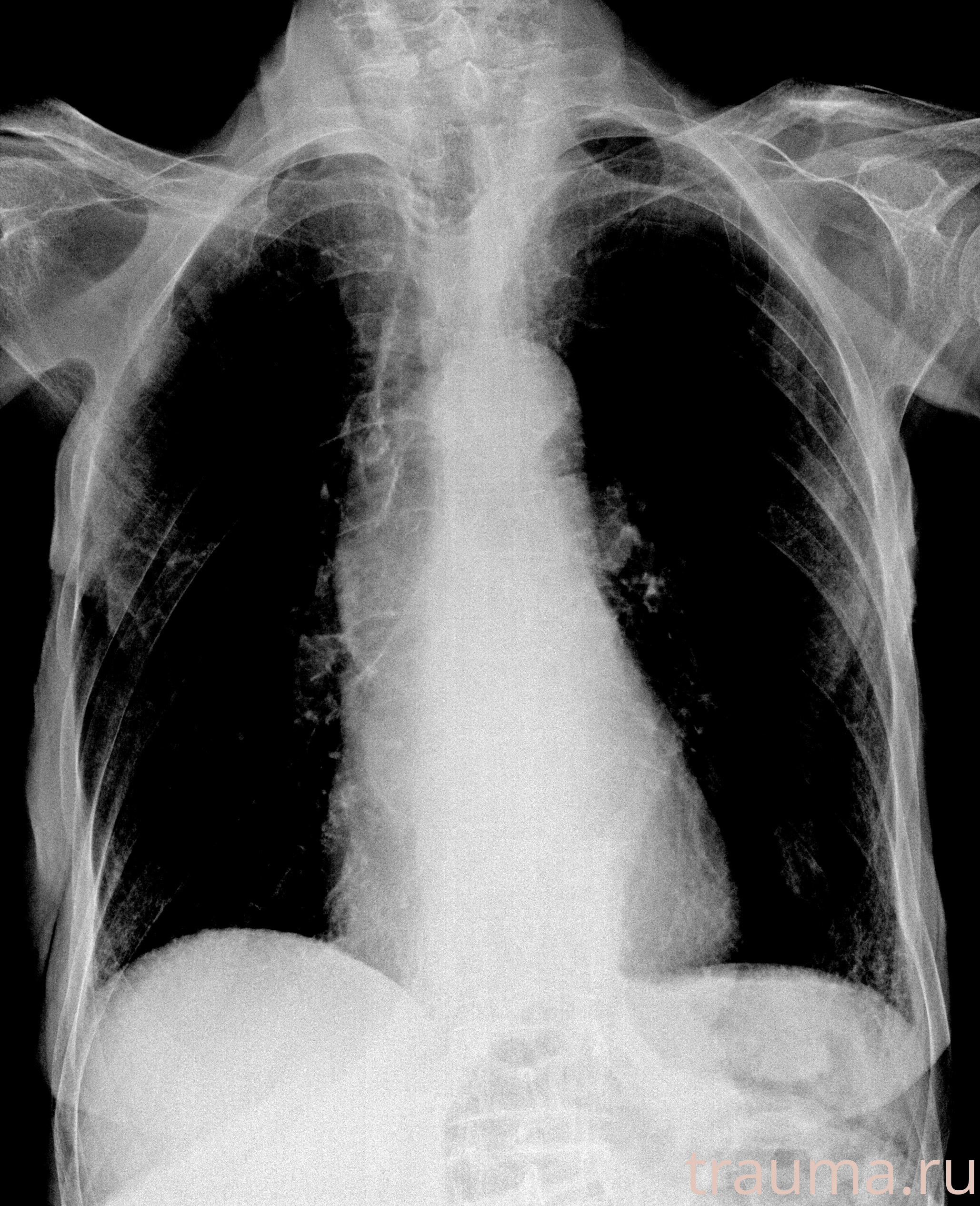 Рентген на дому: по вашему адресу приезжает врач-рентгенолог, травматолог-ортопед с мобильным рентгеновским аппаратом, проводит диагностику травмы или заболевания, делает необходимые рентгенограммы, дает рекомендации по дальнейшему лечению. Получить качественные снимки в домашних условиях возможно благодаря уникальной методике, разработанной МосРентген Центром для института  Склифосовского