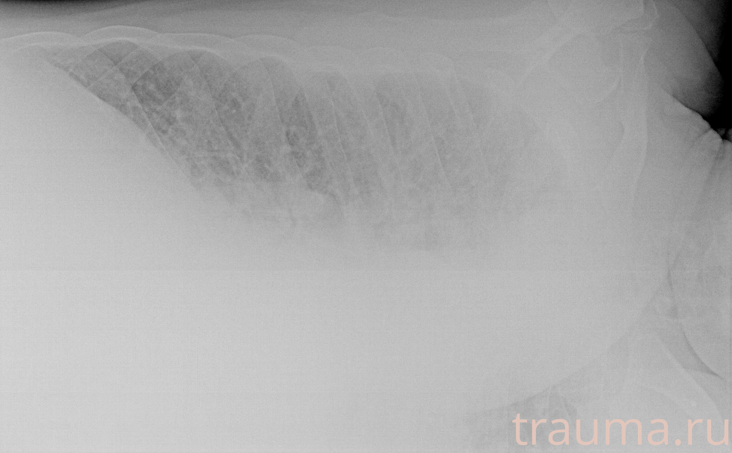 Рентген на дому: по вашему адресу приезжает врач-рентгенолог, травматолог-ортопед с мобильным рентгеновским аппаратом, проводит диагностику травмы или заболевания, делает необходимые рентгенограммы, дает рекомендации по дальнейшему лечению. Получить качественные снимки в домашних условиях возможно благодаря уникальной методике, разработанной МосРентген Центром для института  Склифосовского