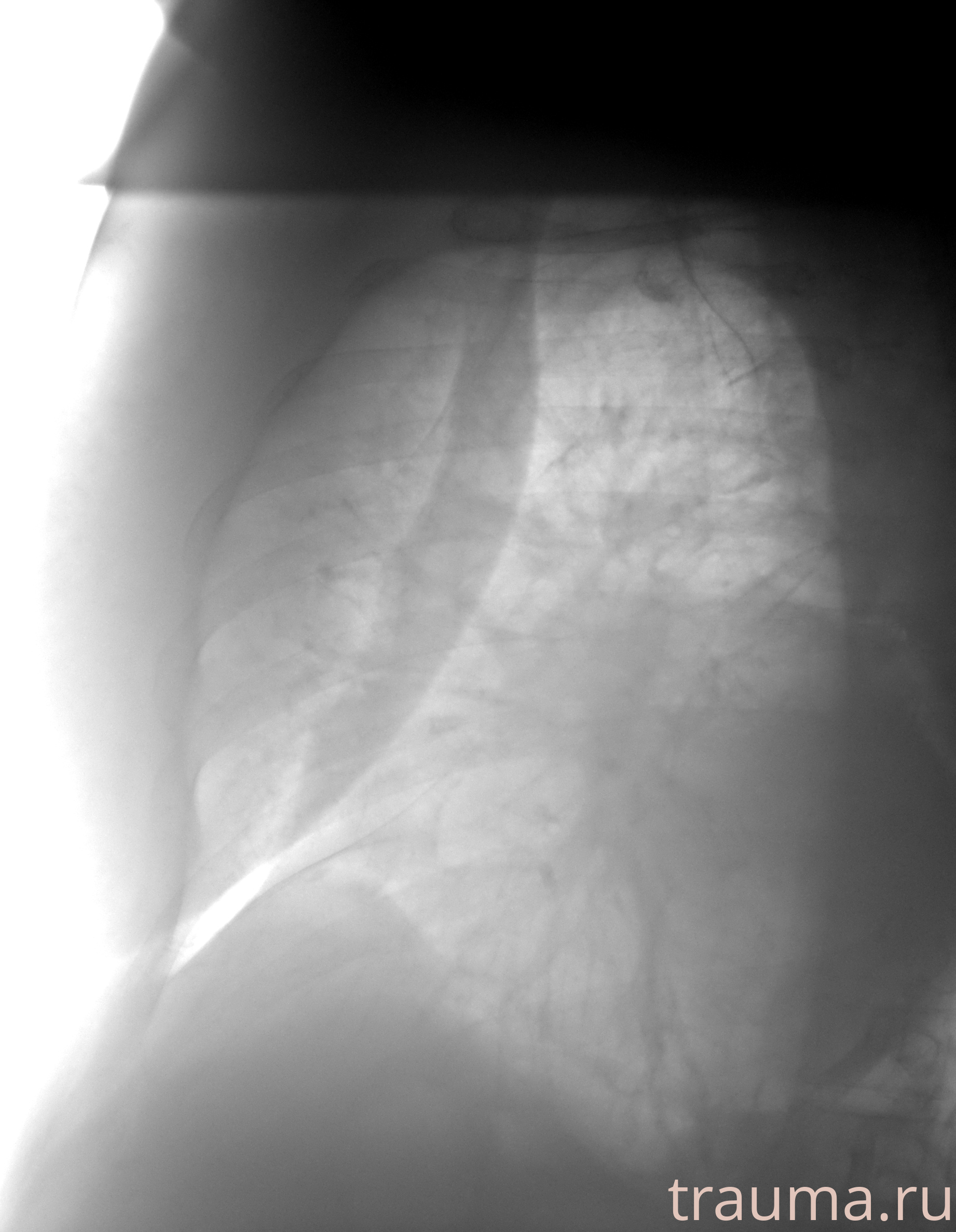 Рентген на дому: по вашему адресу приезжает врач-рентгенолог, травматолог-ортопед с мобильным рентгеновским аппаратом, проводит диагностику травмы или заболевания, делает необходимые рентгенограммы, дает рекомендации по дальнейшему лечению. Получить качественные снимки в домашних условиях возможно благодаря уникальной методике, разработанной МосРентген Центром для института  Склифосовского