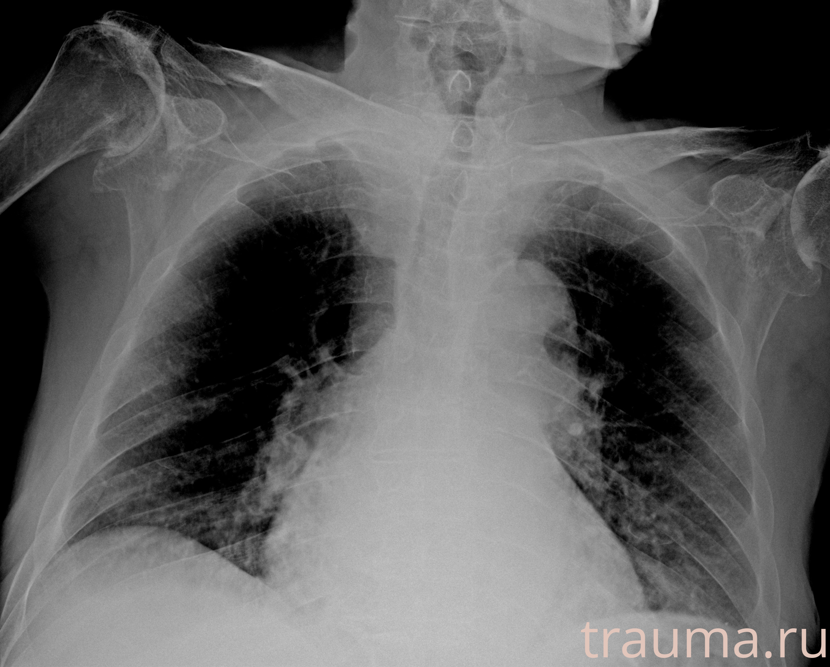 Рентген на дому: по вашему адресу приезжает врач-рентгенолог, травматолог-ортопед с мобильным рентгеновским аппаратом, проводит диагностику травмы или заболевания, делает необходимые рентгенограммы, дает рекомендации по дальнейшему лечению. Получить качественные снимки в домашних условиях возможно благодаря уникальной методике, разработанной МосРентген Центром для института  Склифосовского