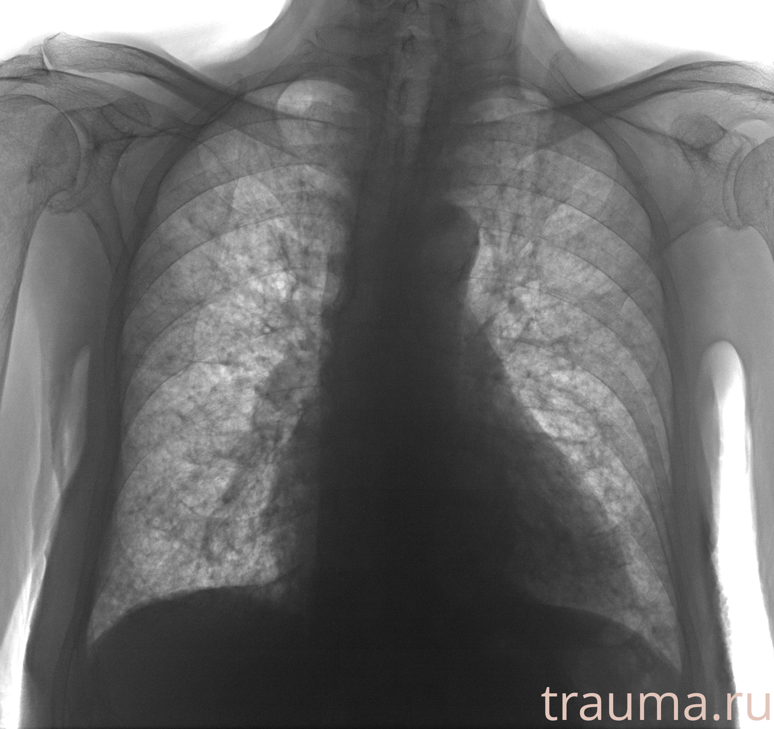 Рентген на дому: по вашему адресу приезжает врач-рентгенолог, травматолог-ортопед с мобильным рентгеновским аппаратом, проводит диагностику травмы или заболевания, делает необходимые рентгенограммы, дает рекомендации по дальнейшему лечению. Получить качественные снимки в домашних условиях возможно благодаря уникальной методике, разработанной МосРентген Центром для института  Склифосовского