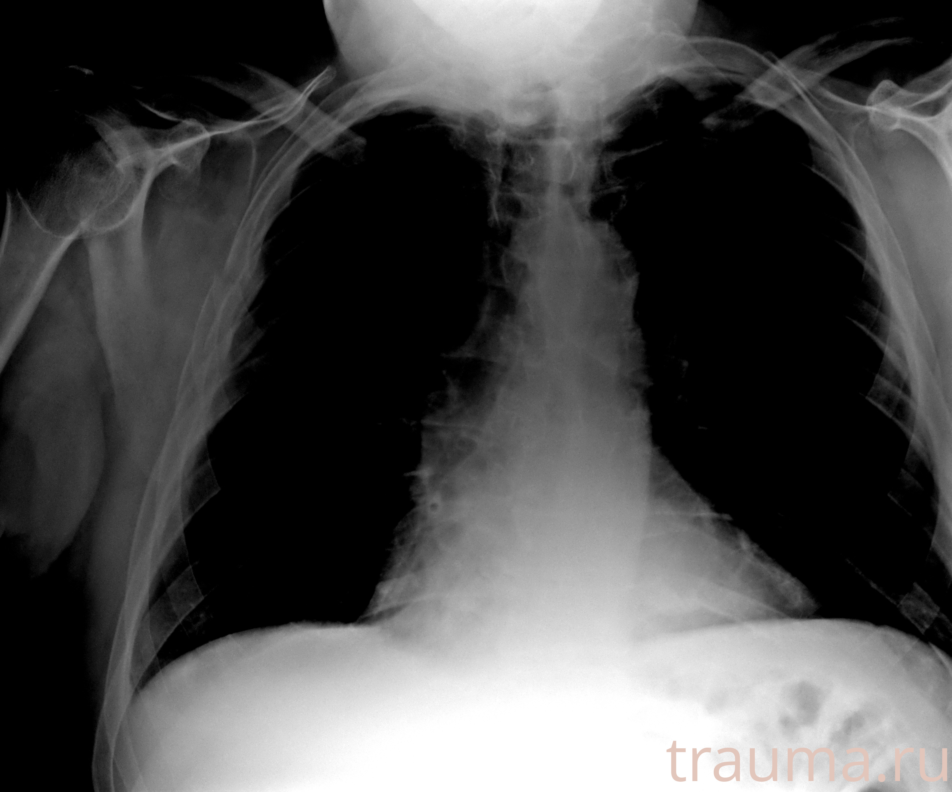 Рентген на дому: по вашему адресу приезжает врач-рентгенолог, травматолог-ортопед с мобильным рентгеновским аппаратом, проводит диагностику травмы или заболевания, делает необходимые рентгенограммы, дает рекомендации по дальнейшему лечению. Получить качественные снимки в домашних условиях возможно благодаря уникальной методике, разработанной МосРентген Центром для института  Склифосовского