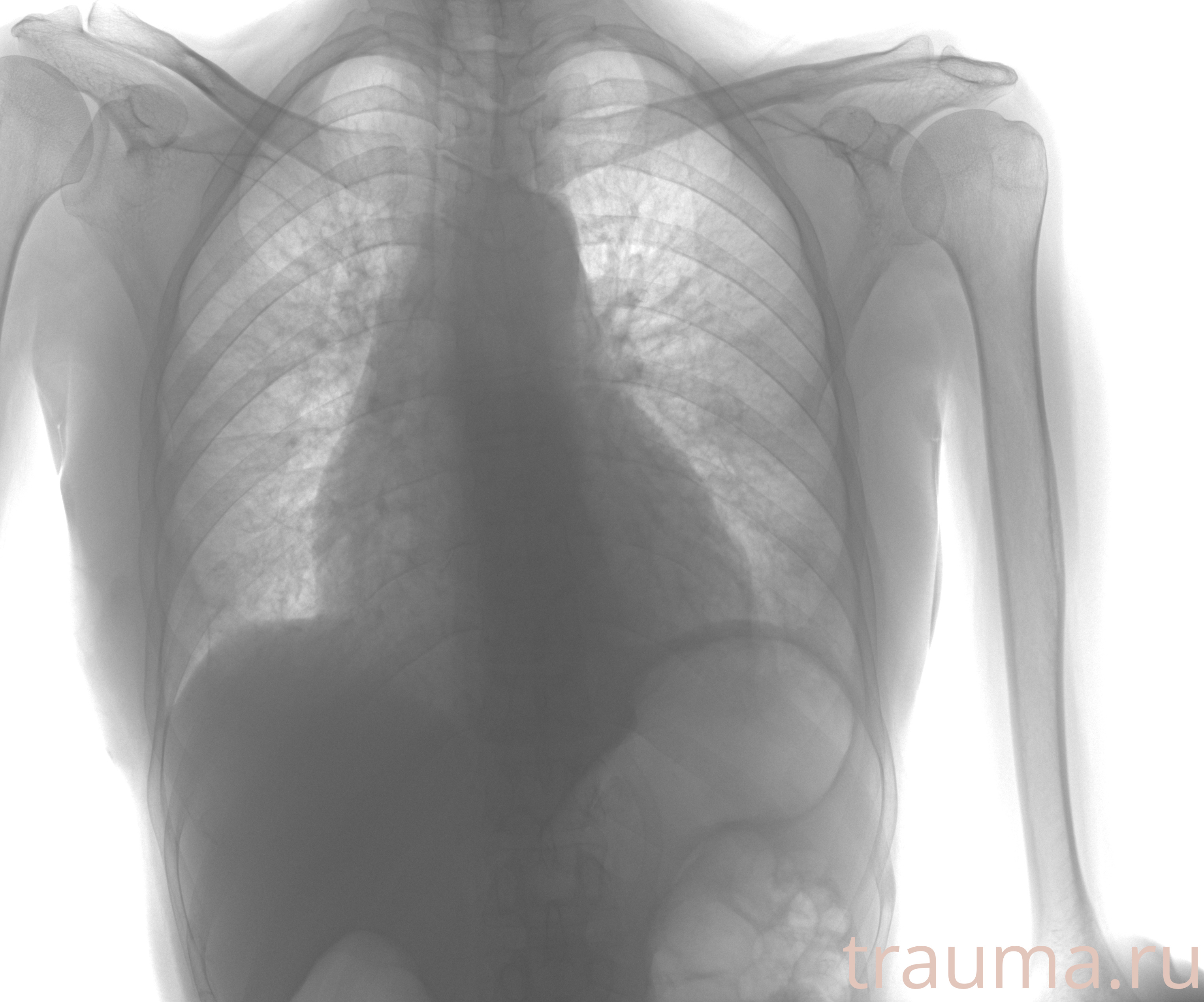 Рентген на дому: по вашему адресу приезжает врач-рентгенолог, травматолог-ортопед с мобильным рентгеновским аппаратом, проводит диагностику травмы или заболевания, делает необходимые рентгенограммы, дает рекомендации по дальнейшему лечению. Получить качественные снимки в домашних условиях возможно благодаря уникальной методике, разработанной МосРентген Центром для института  Склифосовского