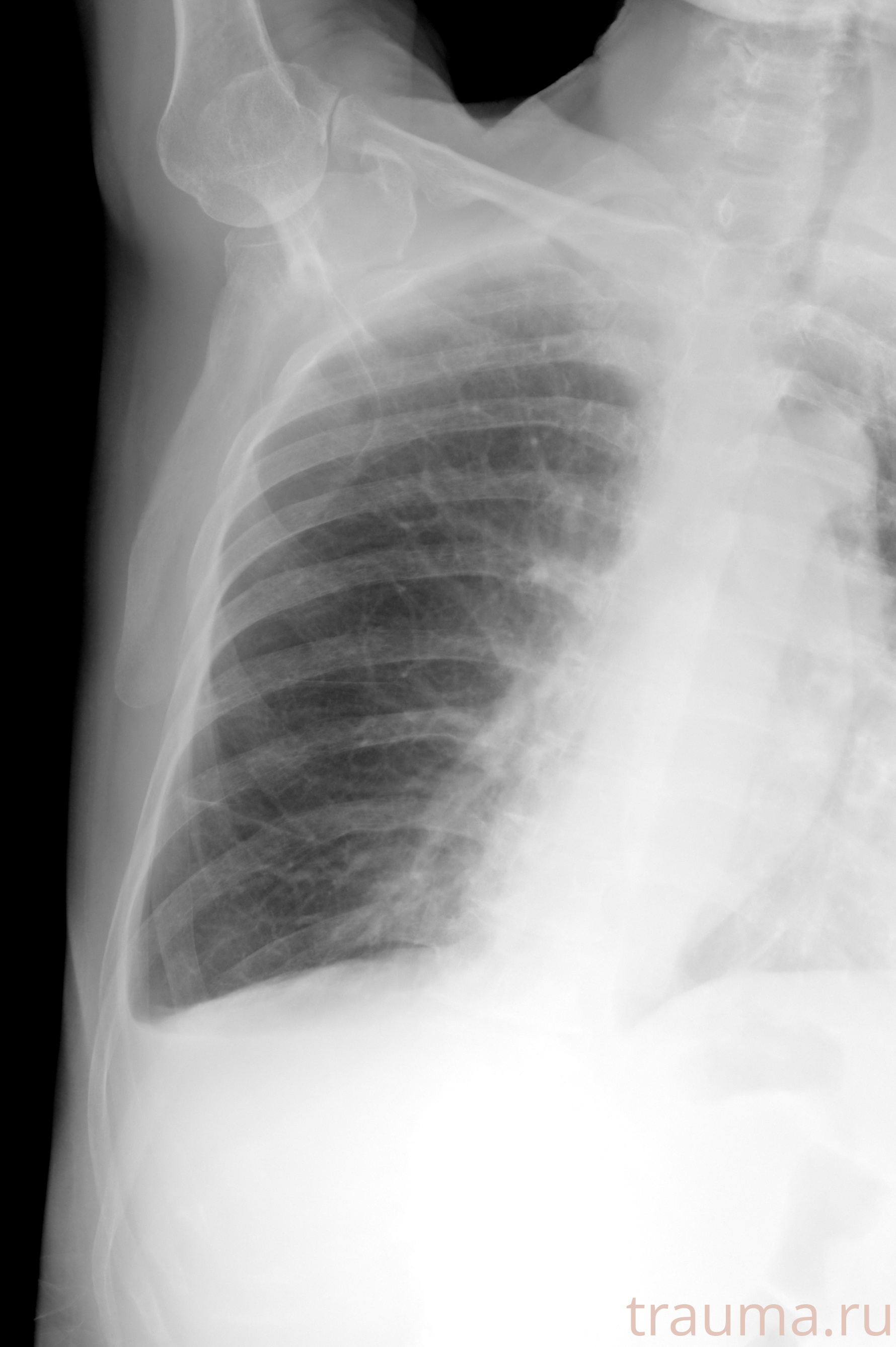 Рентген на дому: по вашему адресу приезжает врач-рентгенолог, травматолог-ортопед с мобильным рентгеновским аппаратом, проводит диагностику травмы или заболевания, делает необходимые рентгенограммы, дает рекомендации по дальнейшему лечению. Получить качественные снимки в домашних условиях возможно благодаря уникальной методике, разработанной МосРентген Центром для института  Склифосовского