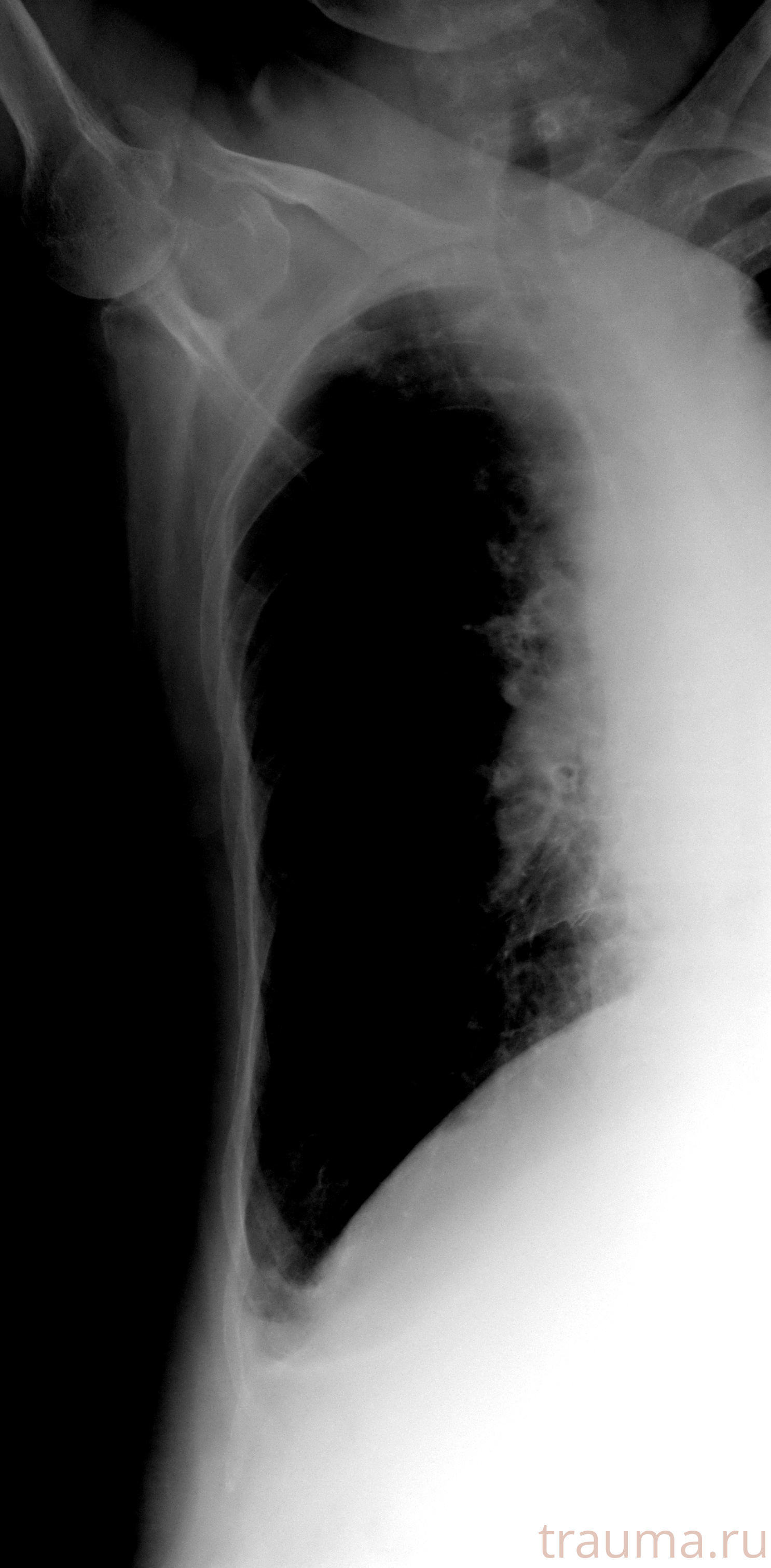 Рентген на дому: по вашему адресу приезжает врач-рентгенолог, травматолог-ортопед с мобильным рентгеновским аппаратом, проводит диагностику травмы или заболевания, делает необходимые рентгенограммы, дает рекомендации по дальнейшему лечению. Получить качественные снимки в домашних условиях возможно благодаря уникальной методике, разработанной МосРентген Центром для института  Склифосовского