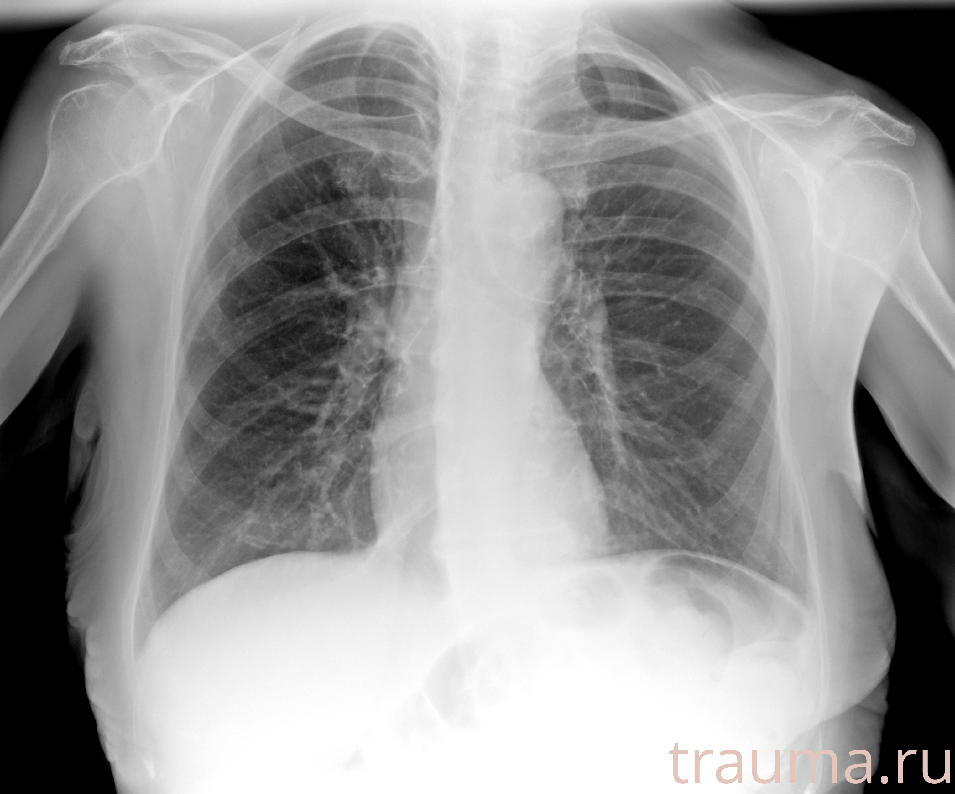 Рентген на дому: по вашему адресу приезжает врач-рентгенолог, травматолог-ортопед с мобильным рентгеновским аппаратом, проводит диагностику травмы или заболевания, делает необходимые рентгенограммы, дает рекомендации по дальнейшему лечению. Получить качественные снимки в домашних условиях возможно благодаря уникальной методике, разработанной МосРентген Центром для института  Склифосовского