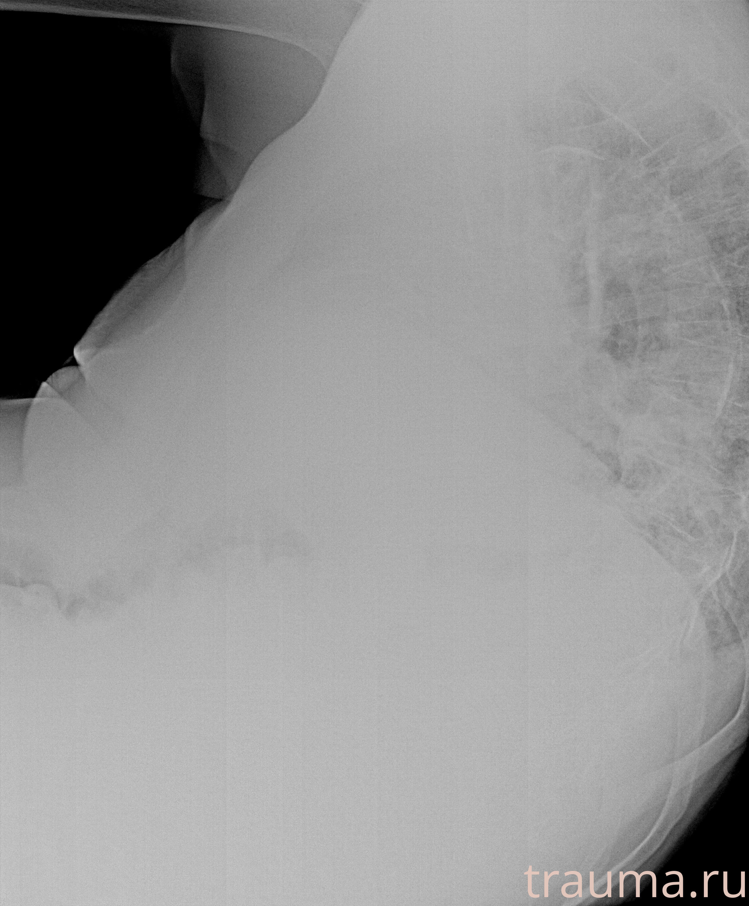 Рентген на дому: по вашему адресу приезжает врач-рентгенолог, травматолог-ортопед с мобильным рентгеновским аппаратом, проводит диагностику травмы или заболевания, делает необходимые рентгенограммы, дает рекомендации по дальнейшему лечению. Получить качественные снимки в домашних условиях возможно благодаря уникальной методике, разработанной МосРентген Центром для института  Склифосовского