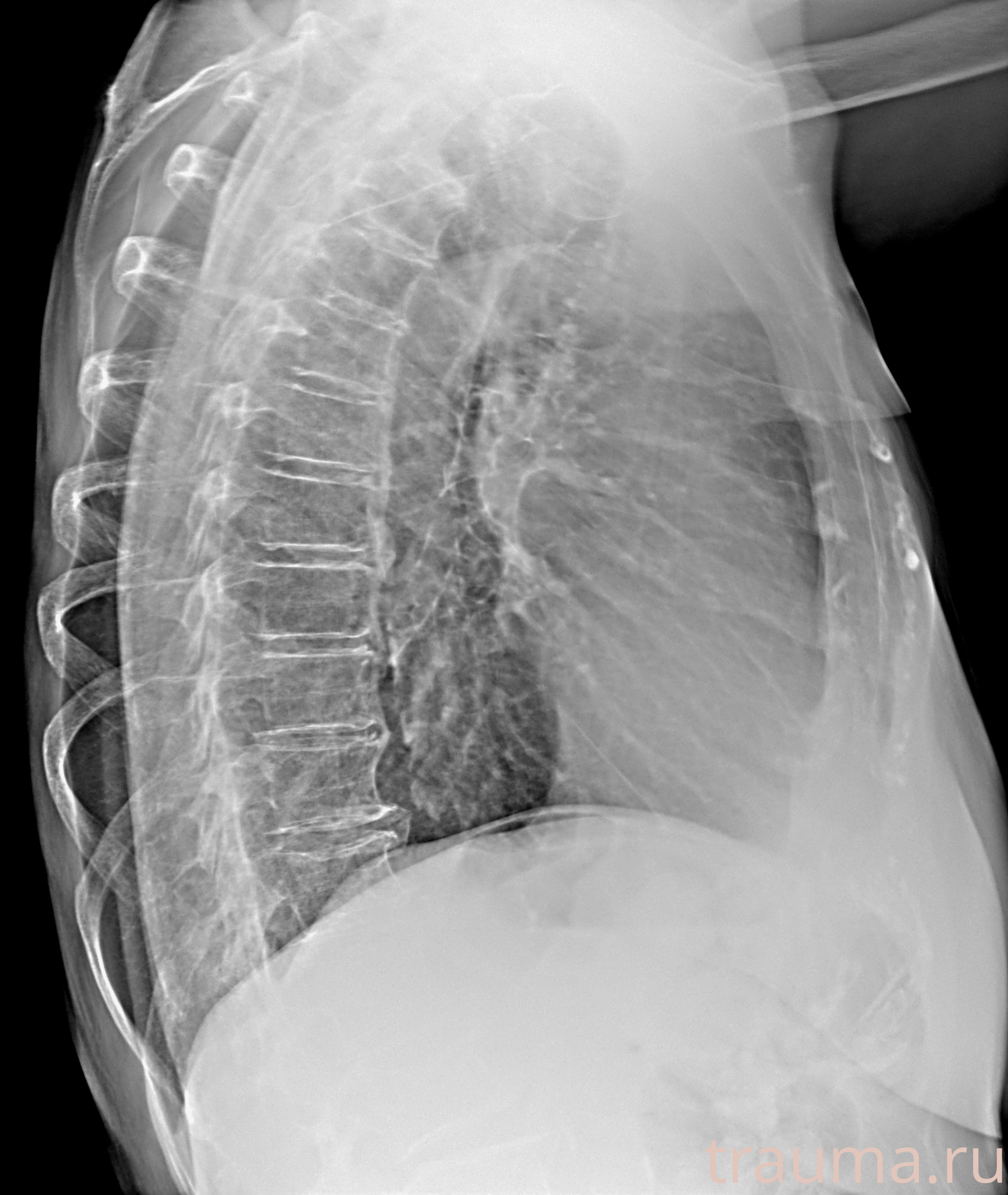 Рентген на дому: по вашему адресу приезжает врач-рентгенолог, травматолог-ортопед с мобильным рентгеновским аппаратом, проводит диагностику травмы или заболевания, делает необходимые рентгенограммы, дает рекомендации по дальнейшему лечению. Получить качественные снимки в домашних условиях возможно благодаря уникальной методике, разработанной МосРентген Центром для института  Склифосовского