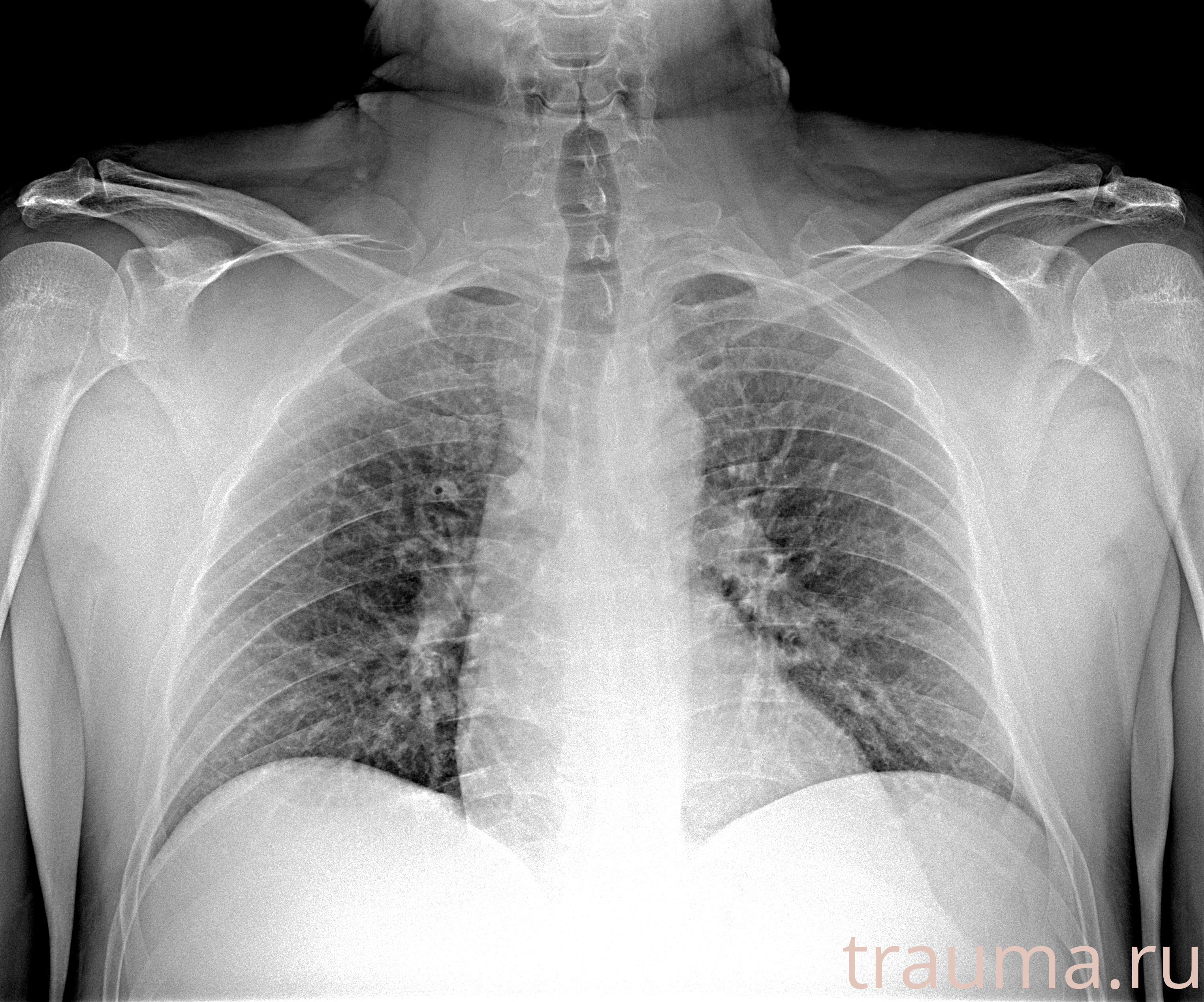 Рентген на дому: по вашему адресу приезжает врач-рентгенолог, травматолог-ортопед с мобильным рентгеновским аппаратом, проводит диагностику травмы или заболевания, делает необходимые рентгенограммы, дает рекомендации по дальнейшему лечению. Получить качественные снимки в домашних условиях возможно благодаря уникальной методике, разработанной МосРентген Центром для института  Склифосовского