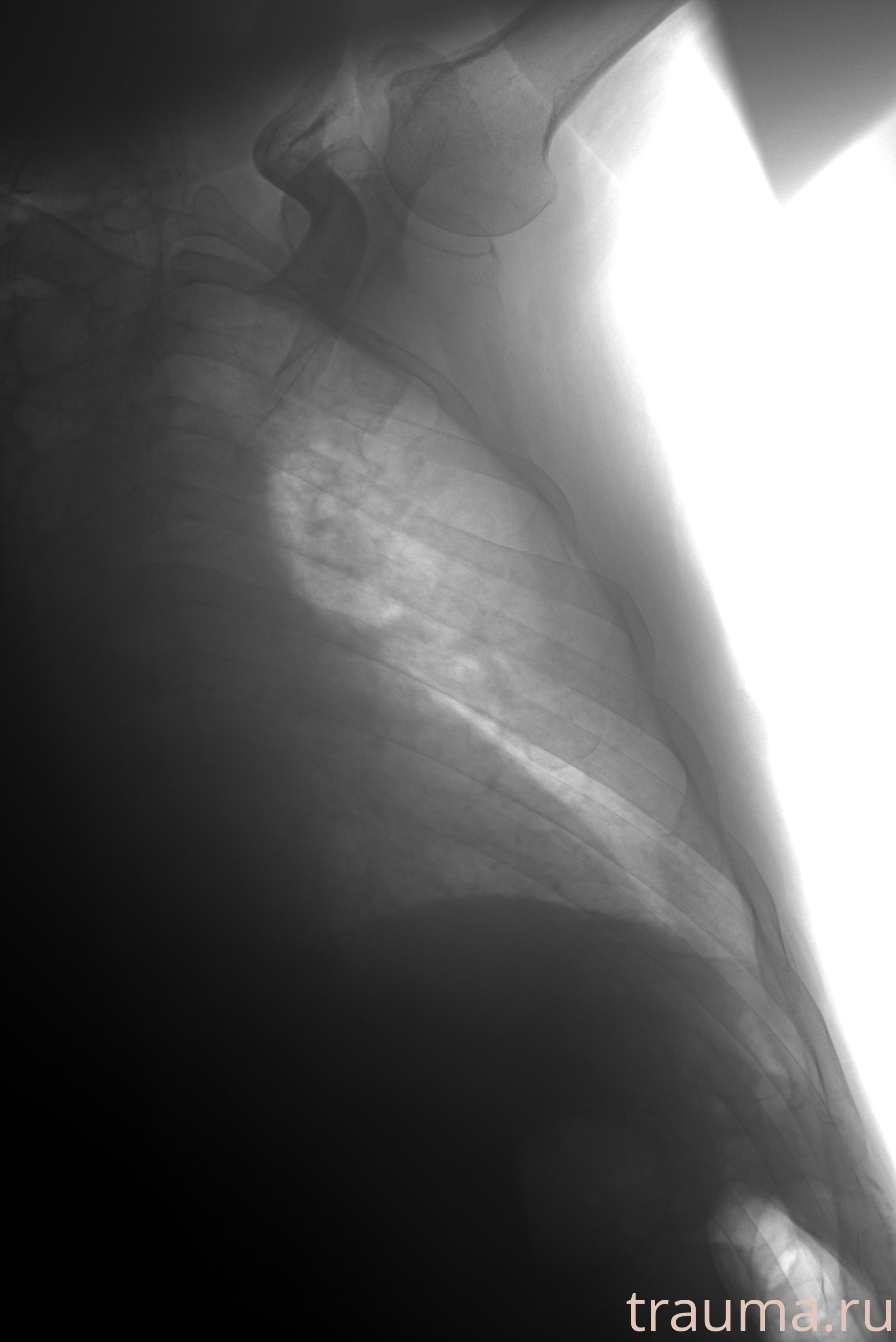 Рентген на дому: по вашему адресу приезжает врач-рентгенолог, травматолог-ортопед с мобильным рентгеновским аппаратом, проводит диагностику травмы или заболевания, делает необходимые рентгенограммы, дает рекомендации по дальнейшему лечению. Получить качественные снимки в домашних условиях возможно благодаря уникальной методике, разработанной МосРентген Центром для института  Склифосовского