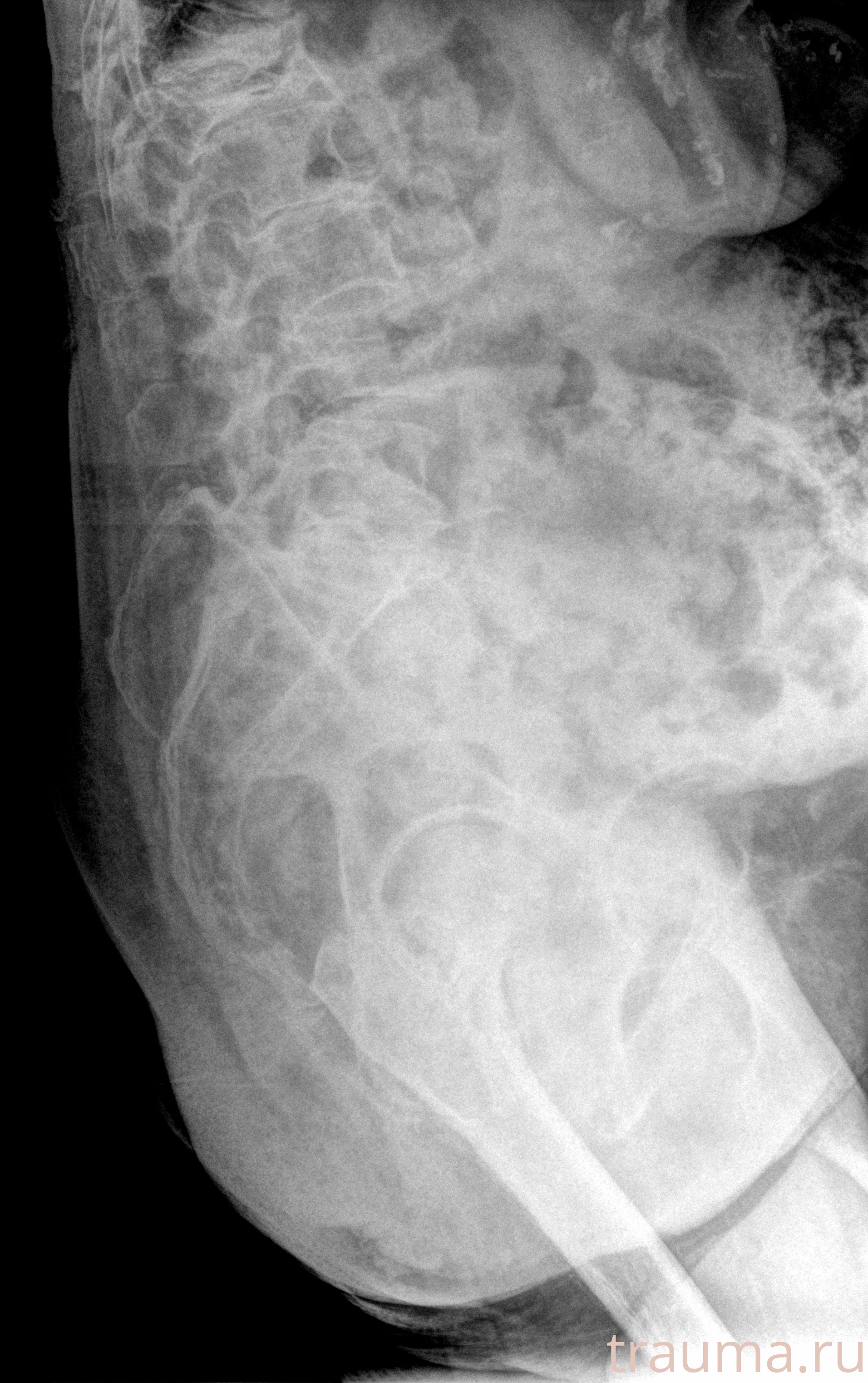 Рентген на дому: по вашему адресу приезжает врач-рентгенолог, травматолог-ортопед с мобильным рентгеновским аппаратом, проводит диагностику травмы или заболевания, делает необходимые рентгенограммы, дает рекомендации по дальнейшему лечению. Получить качественные снимки в домашних условиях возможно благодаря уникальной методике, разработанной МосРентген Центром для института  Склифосовского