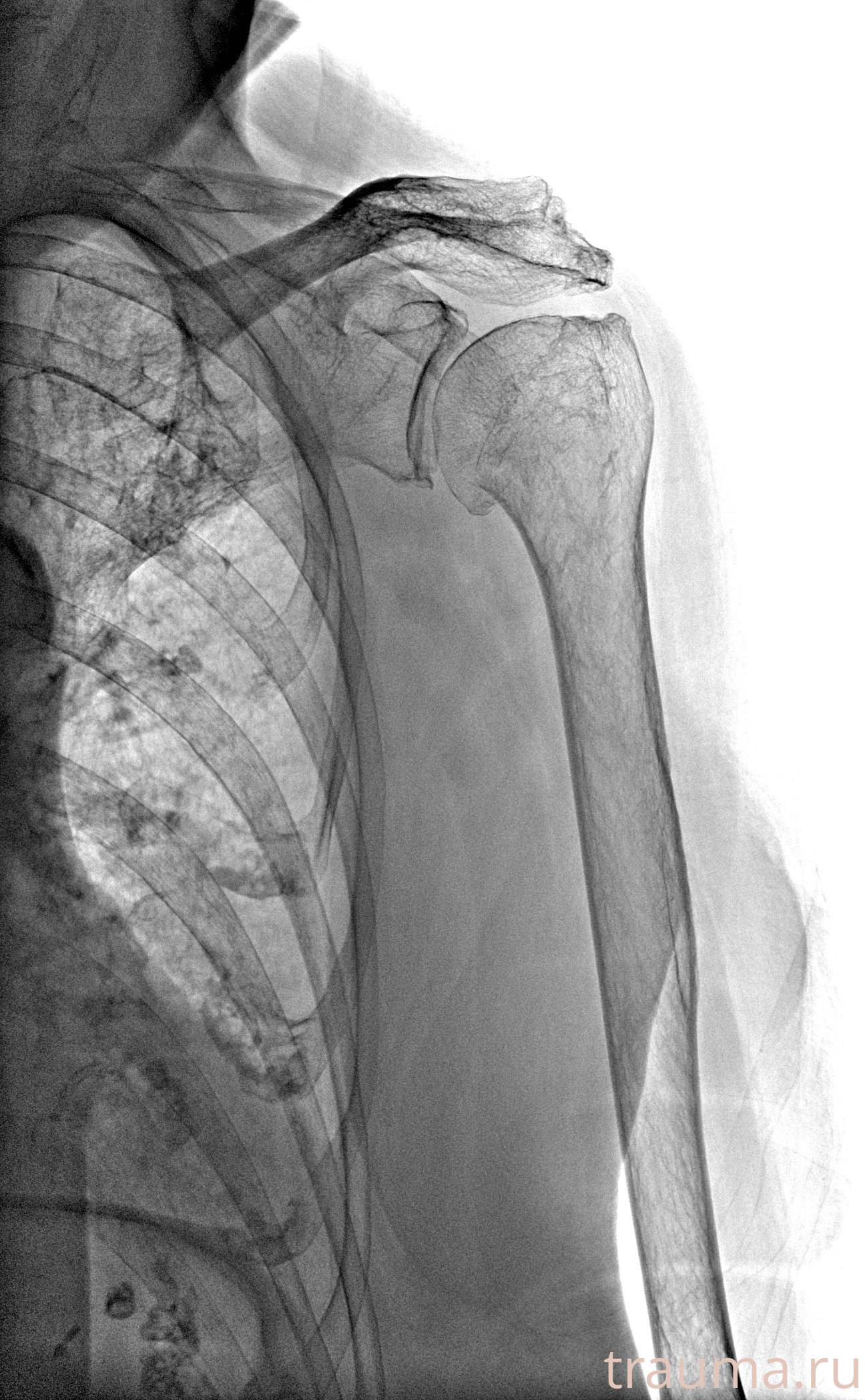 Рентген на дому: по вашему адресу приезжает врач-рентгенолог, травматолог-ортопед с мобильным рентгеновским аппаратом, проводит диагностику травмы или заболевания, делает необходимые рентгенограммы, дает рекомендации по дальнейшему лечению. Получить качественные снимки в домашних условиях возможно благодаря уникальной методике, разработанной МосРентген Центром для института  Склифосовского