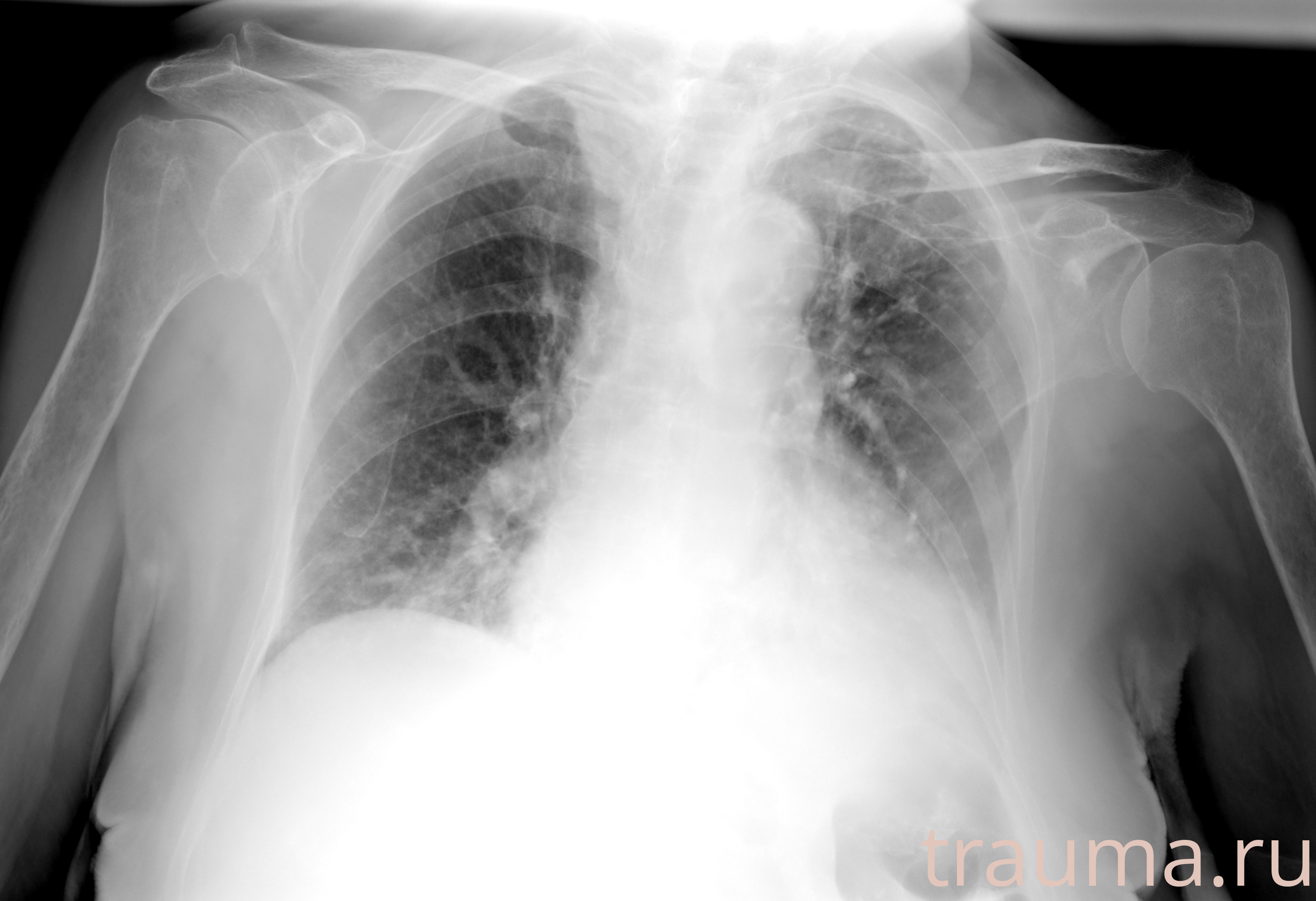 Рентген на дому: по вашему адресу приезжает врач-рентгенолог, травматолог-ортопед с мобильным рентгеновским аппаратом, проводит диагностику травмы или заболевания, делает необходимые рентгенограммы, дает рекомендации по дальнейшему лечению. Получить качественные снимки в домашних условиях возможно благодаря уникальной методике, разработанной МосРентген Центром для института  Склифосовского