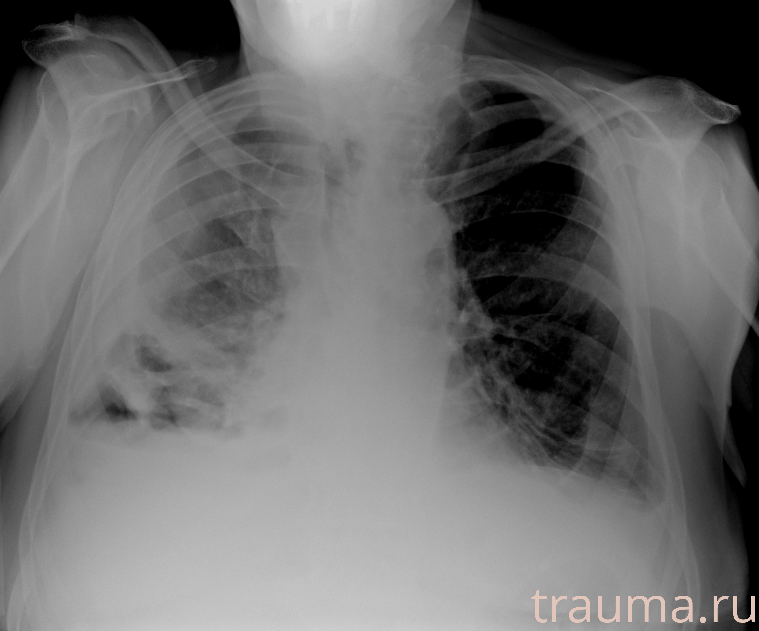 Рентген на дому: по вашему адресу приезжает врач-рентгенолог, травматолог-ортопед с мобильным рентгеновским аппаратом, проводит диагностику травмы или заболевания, делает необходимые рентгенограммы, дает рекомендации по дальнейшему лечению. Получить качественные снимки в домашних условиях возможно благодаря уникальной методике, разработанной МосРентген Центром для института  Склифосовского