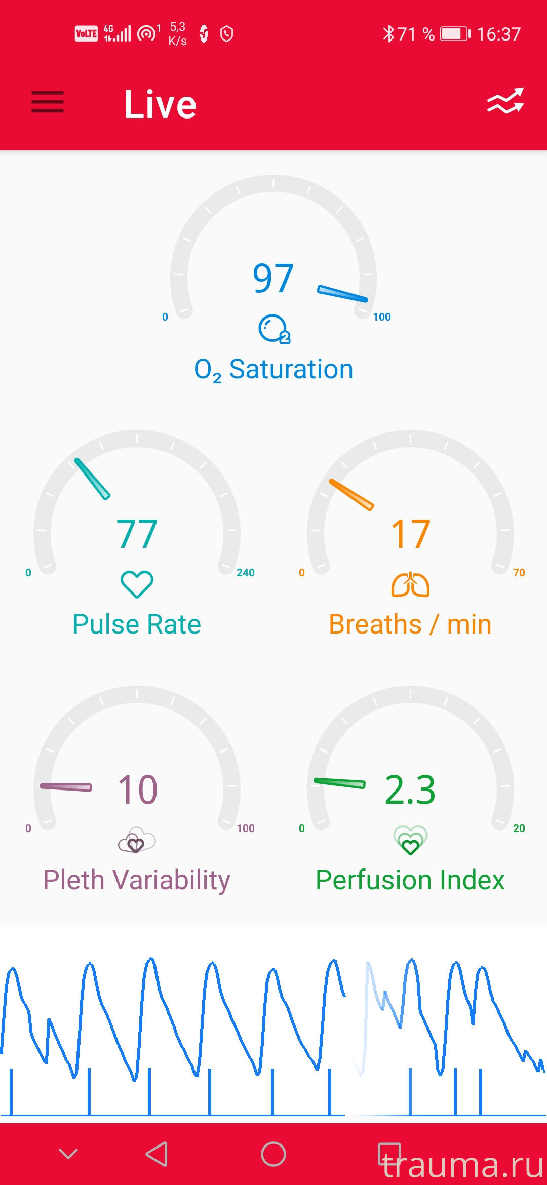 Рентген на дому: по вашему адресу приезжает врач-рентгенолог, травматолог-ортопед с мобильным рентгеновским аппаратом, проводит диагностику травмы или заболевания, делает необходимые рентгенограммы, дает рекомендации по дальнейшему лечению. Получить качественные снимки в домашних условиях возможно благодаря уникальной методике, разработанной МосРентген Центром для института  Склифосовского