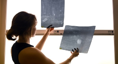 ИИ научили диагностировать туберкулез на рентгеновских снимках