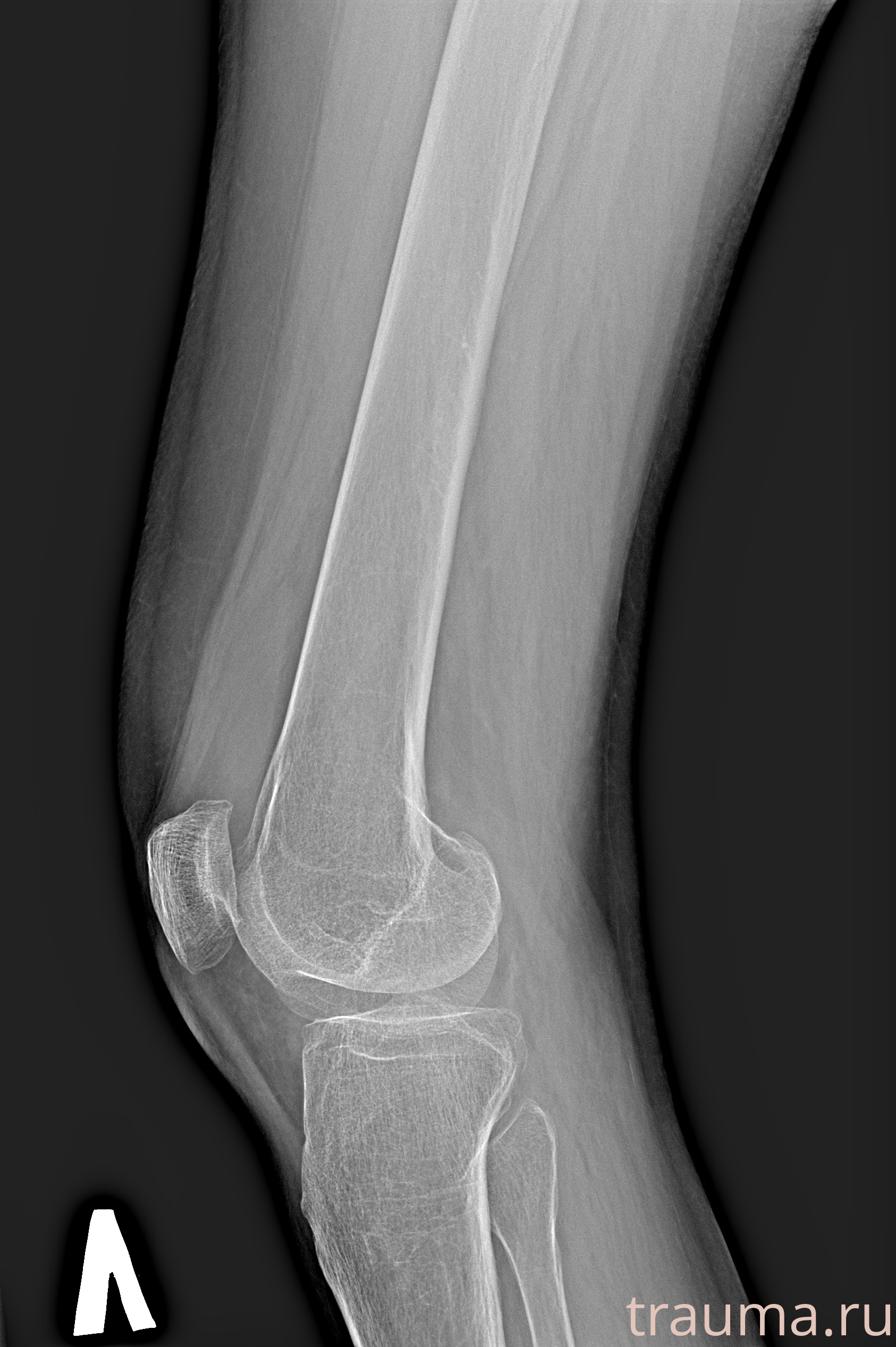 Рентген на дому: по вашему адресу приезжает врач-рентгенолог, травматолог-ортопед с мобильным рентгеновским аппаратом, проводит диагностику травмы или заболевания, делает необходимые рентгенограммы, дает рекомендации по дальнейшему лечению. Получить качественные снимки в домашних условиях возможно благодаря уникальной методике, разработанной МосРентген Центром для института  Склифосовского