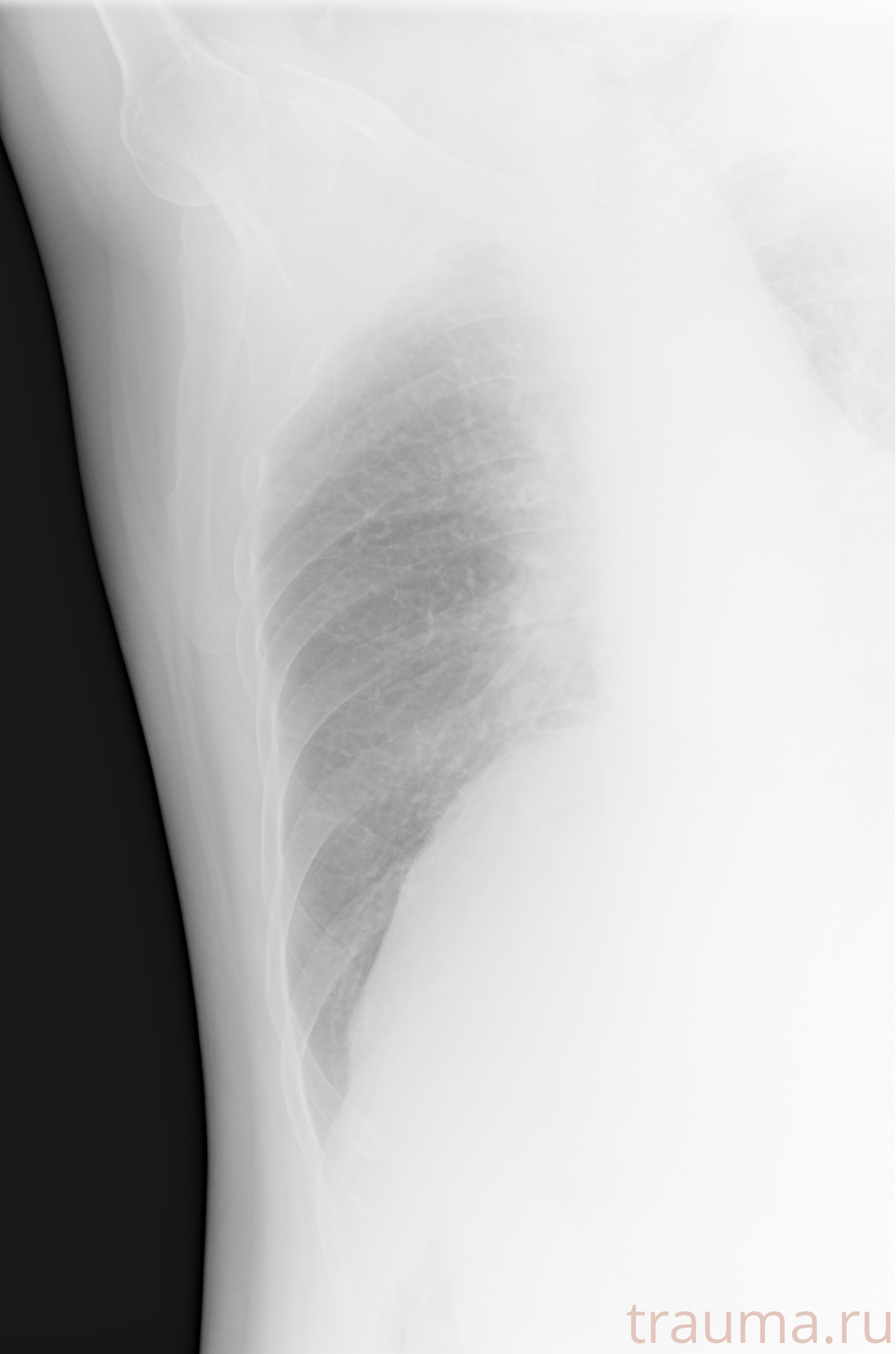 Рентген на дому: по вашему адресу приезжает врач-рентгенолог, травматолог-ортопед с мобильным рентгеновским аппаратом, проводит диагностику травмы или заболевания, делает необходимые рентгенограммы, дает рекомендации по дальнейшему лечению. Получить качественные снимки в домашних условиях возможно благодаря уникальной методике, разработанной МосРентген Центром для института  Склифосовского