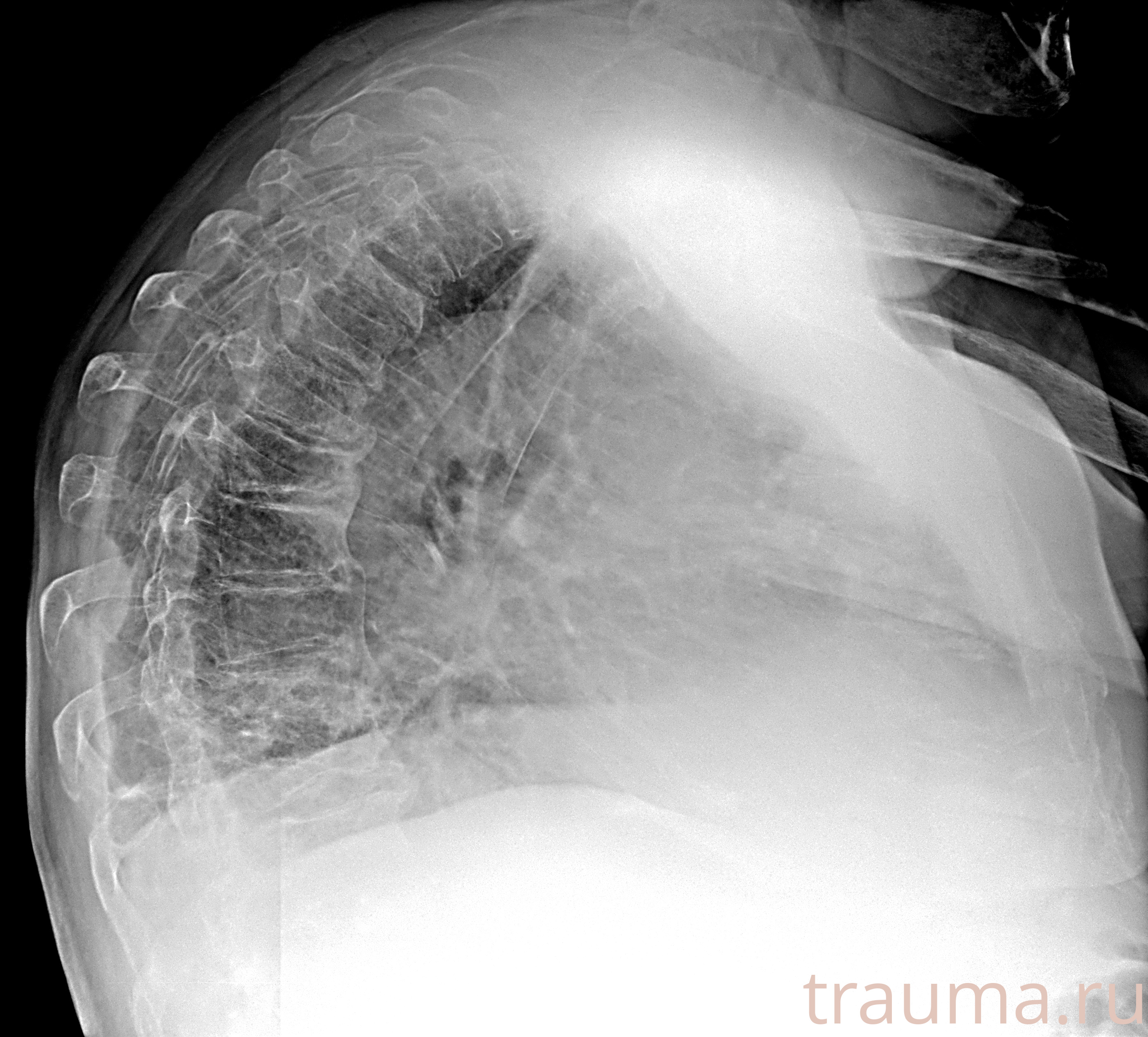 Рентген на дому: по вашему адресу приезжает врач-рентгенолог, травматолог-ортопед с мобильным рентгеновским аппаратом, проводит диагностику травмы или заболевания, делает необходимые рентгенограммы, дает рекомендации по дальнейшему лечению. Получить качественные снимки в домашних условиях возможно благодаря уникальной методике, разработанной МосРентген Центром для института  Склифосовского