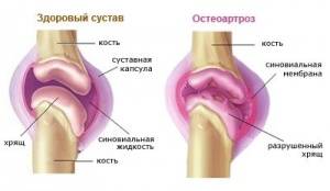 Параклинические методы оценки состояния больных, подлежащих эндопротезированию