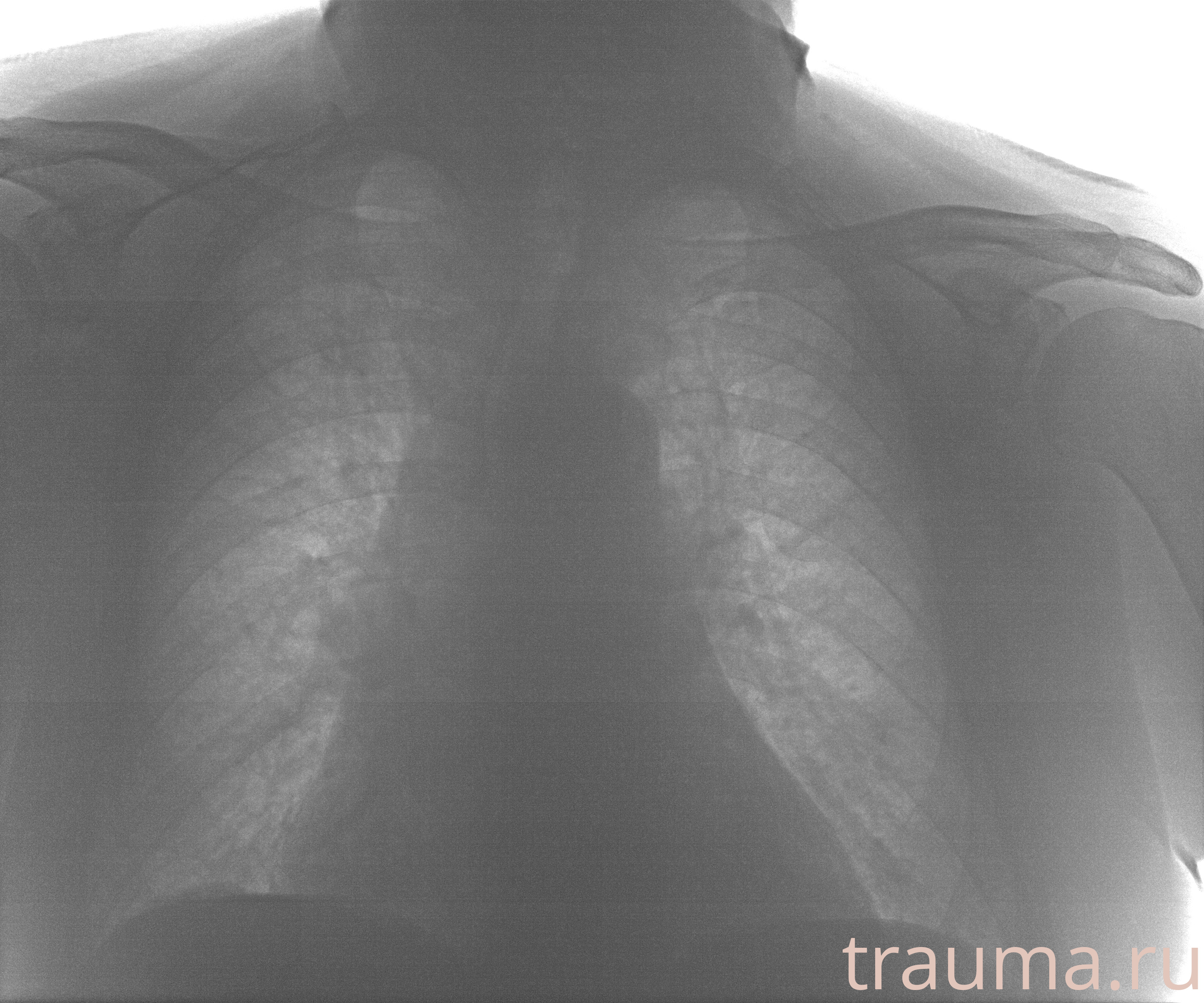 Рентген на дому: по вашему адресу приезжает врач-рентгенолог, травматолог-ортопед с мобильным рентгеновским аппаратом, проводит диагностику травмы или заболевания, делает необходимые рентгенограммы, дает рекомендации по дальнейшему лечению. Получить качественные снимки в домашних условиях возможно благодаря уникальной методике, разработанной МосРентген Центром для института  Склифосовского