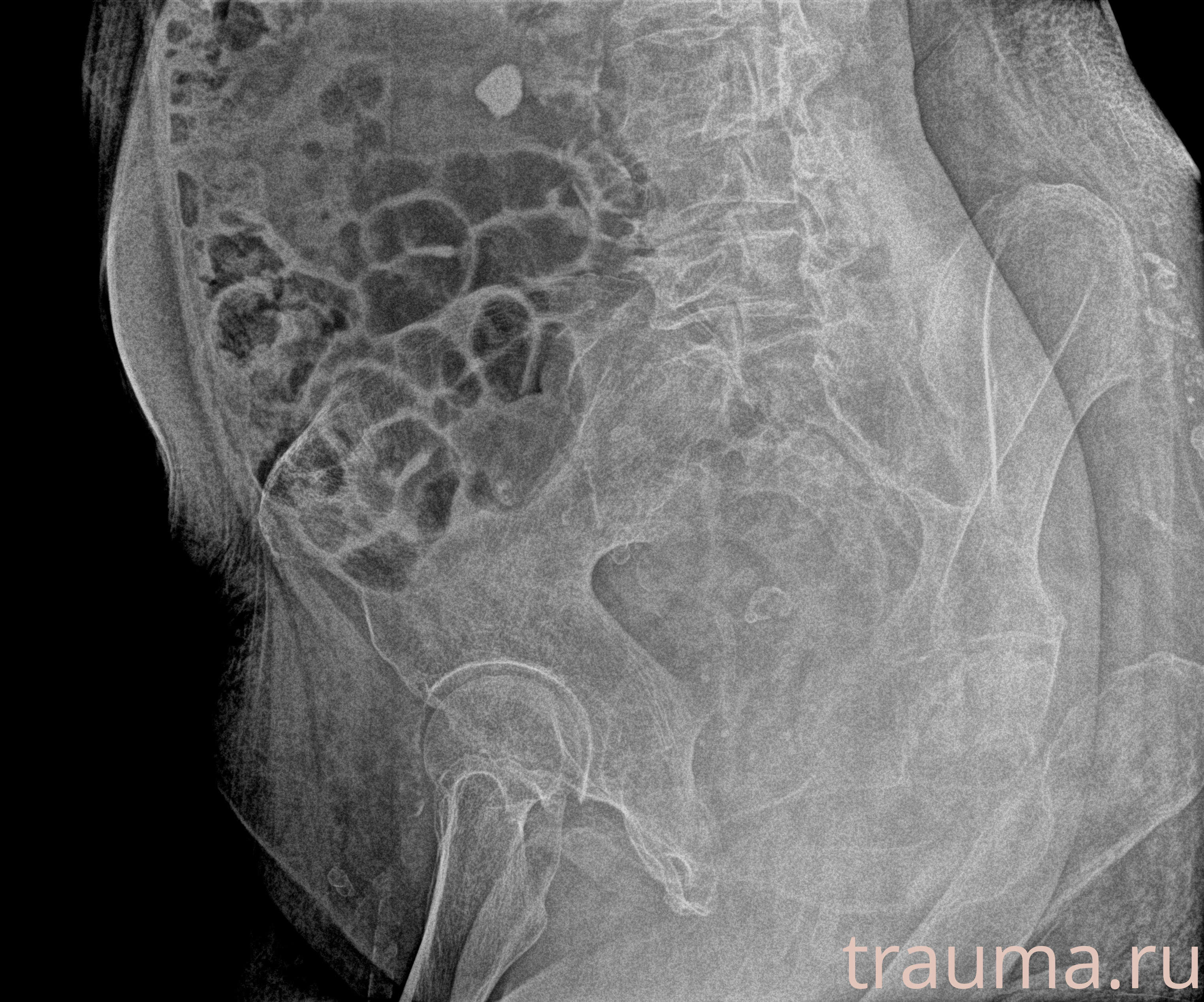 Рентген на дому: по вашему адресу приезжает врач-рентгенолог, травматолог-ортопед с мобильным рентгеновским аппаратом, проводит диагностику травмы или заболевания, делает необходимые рентгенограммы, дает рекомендации по дальнейшему лечению. Получить качественные снимки в домашних условиях возможно благодаря уникальной методике, разработанной МосРентген Центром для института  Склифосовского