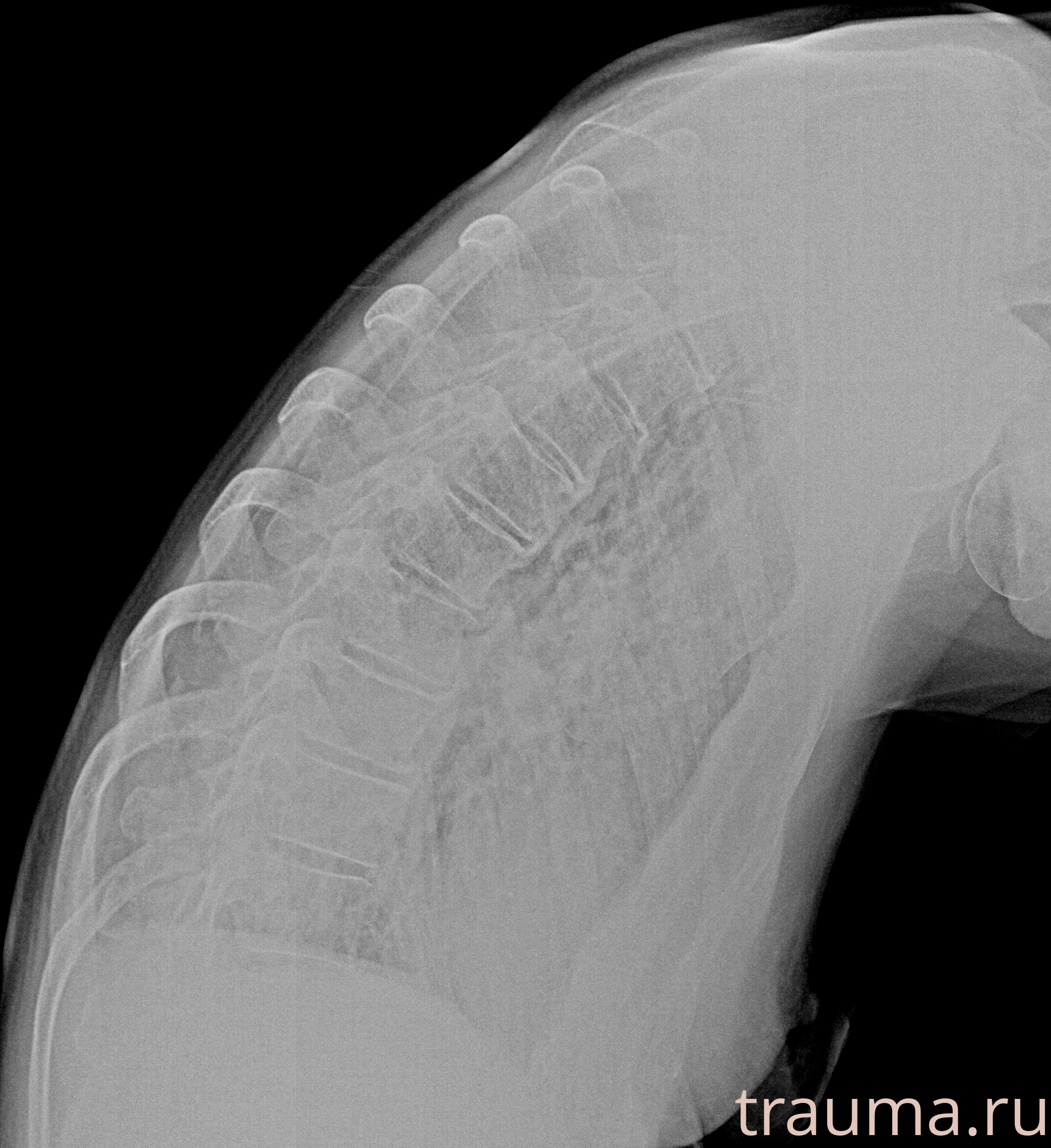 Рентген на дому: по вашему адресу приезжает врач-рентгенолог, травматолог-ортопед с мобильным рентгеновским аппаратом, проводит диагностику травмы или заболевания, делает необходимые рентгенограммы, дает рекомендации по дальнейшему лечению. Получить качественные снимки в домашних условиях возможно благодаря уникальной методике, разработанной МосРентген Центром для института  Склифосовского