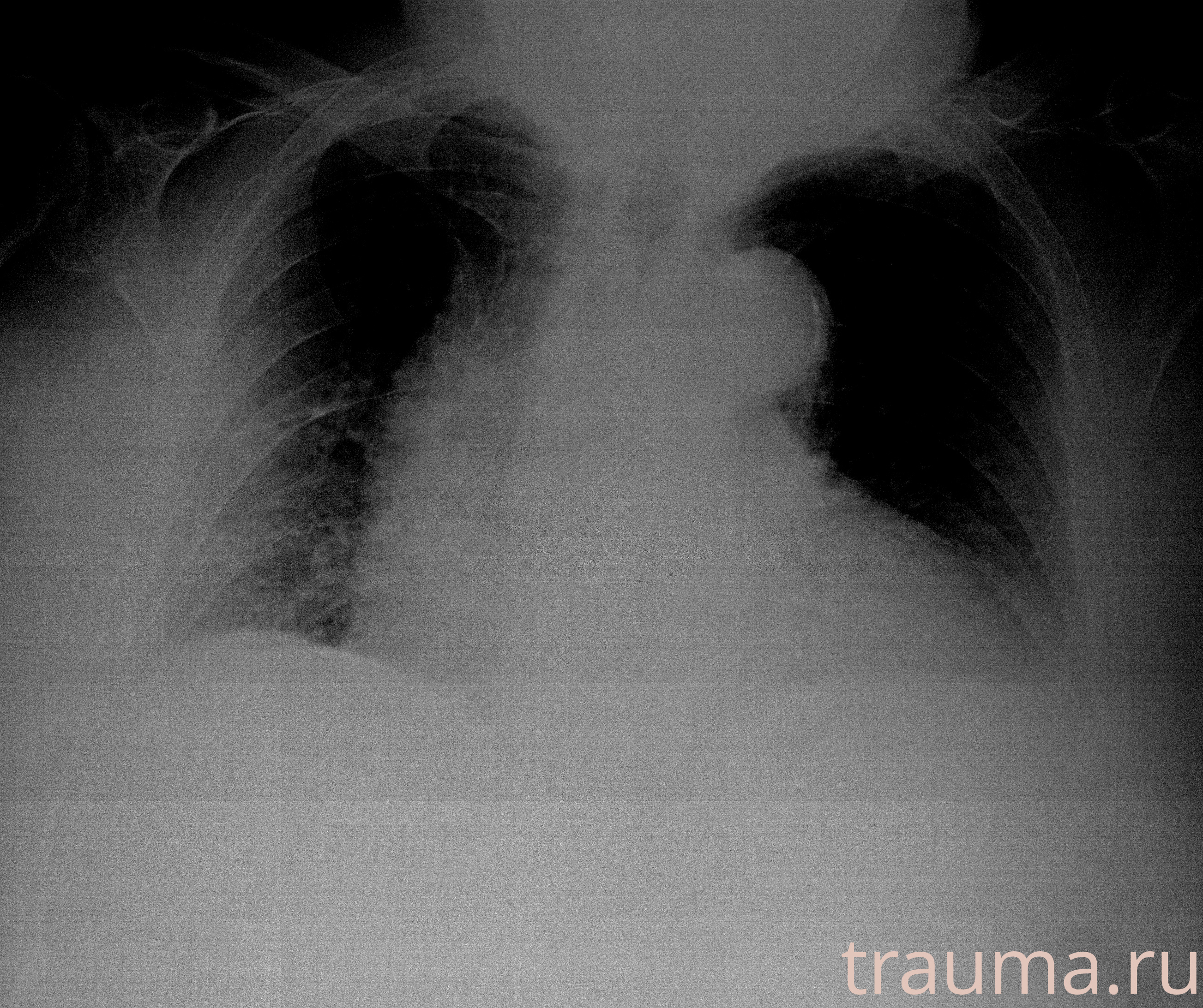 Рентген на дому: по вашему адресу приезжает врач-рентгенолог, травматолог-ортопед с мобильным рентгеновским аппаратом, проводит диагностику травмы или заболевания, делает необходимые рентгенограммы, дает рекомендации по дальнейшему лечению. Получить качественные снимки в домашних условиях возможно благодаря уникальной методике, разработанной МосРентген Центром для института  Склифосовского