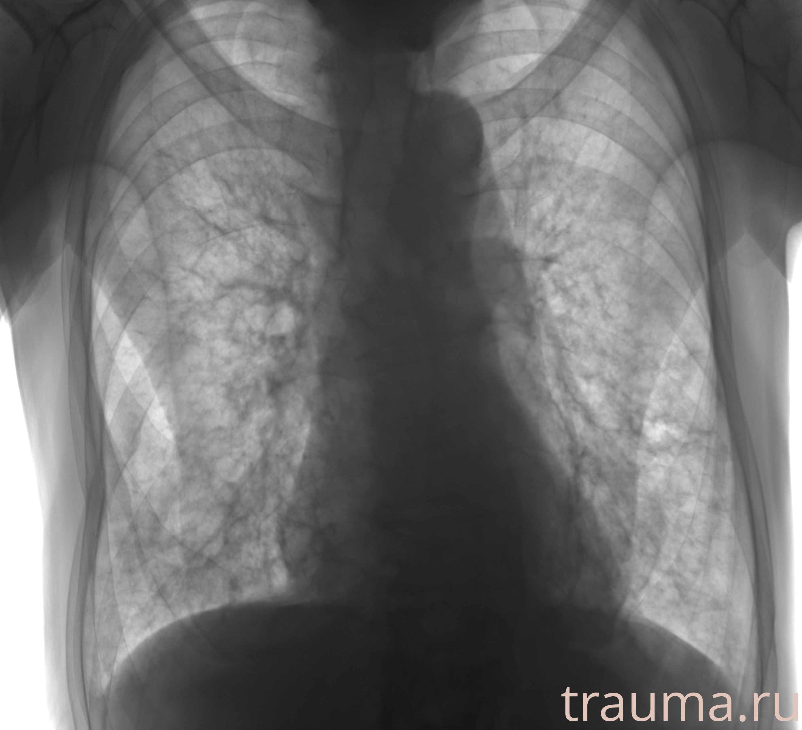 Рентген на дому: по вашему адресу приезжает врач-рентгенолог, травматолог-ортопед с мобильным рентгеновским аппаратом, проводит диагностику травмы или заболевания, делает необходимые рентгенограммы, дает рекомендации по дальнейшему лечению. Получить качественные снимки в домашних условиях возможно благодаря уникальной методике, разработанной МосРентген Центром для института  Склифосовского