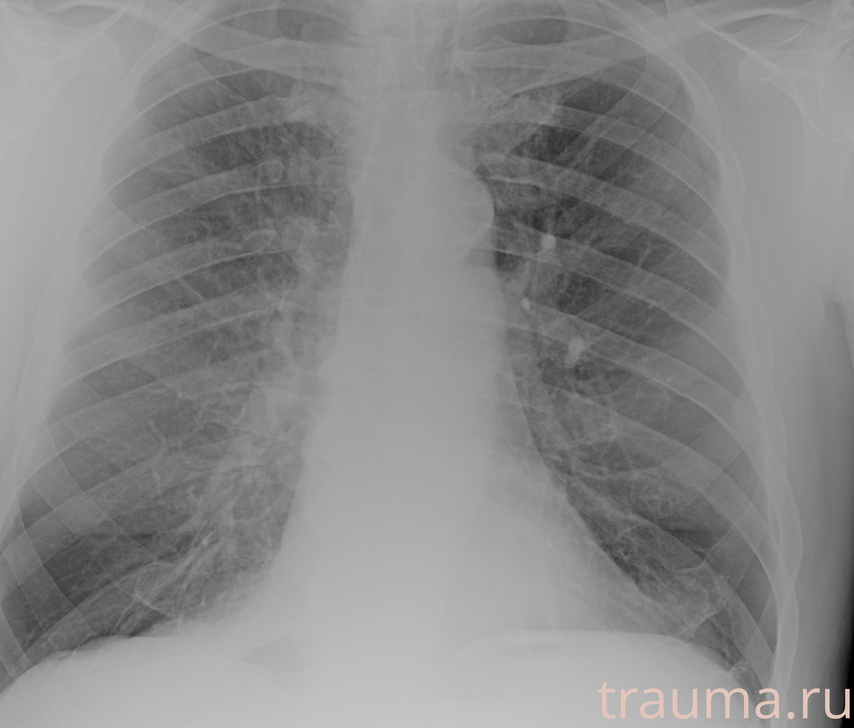 Рентген на дому: по вашему адресу приезжает врач-рентгенолог, травматолог-ортопед с мобильным рентгеновским аппаратом, проводит диагностику травмы или заболевания, делает необходимые рентгенограммы, дает рекомендации по дальнейшему лечению. Получить качественные снимки в домашних условиях возможно благодаря уникальной методике, разработанной МосРентген Центром для института  Склифосовского