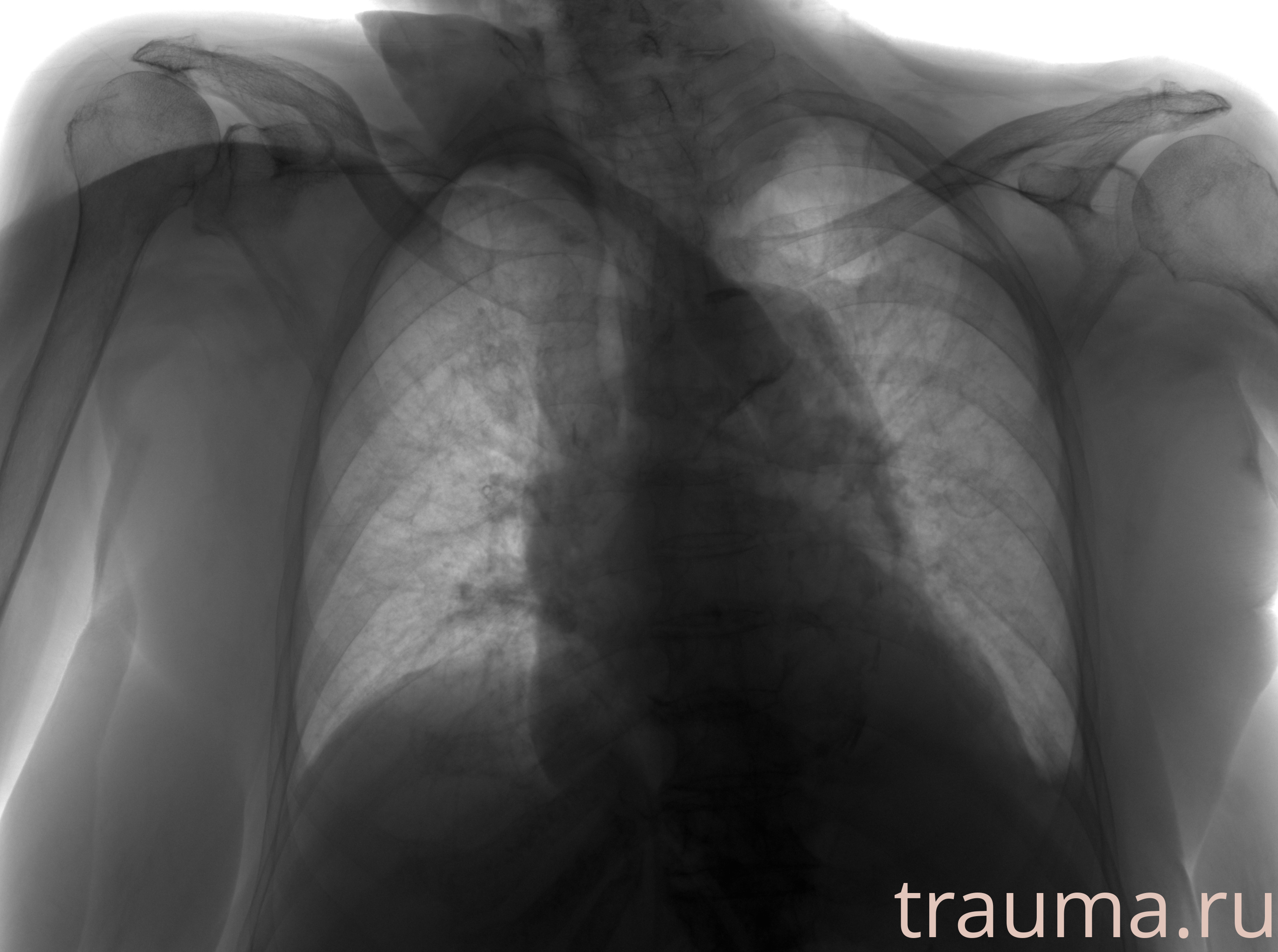 Рентген на дому: по вашему адресу приезжает врач-рентгенолог, травматолог-ортопед с мобильным рентгеновским аппаратом, проводит диагностику травмы или заболевания, делает необходимые рентгенограммы, дает рекомендации по дальнейшему лечению. Получить качественные снимки в домашних условиях возможно благодаря уникальной методике, разработанной МосРентген Центром для института  Склифосовского