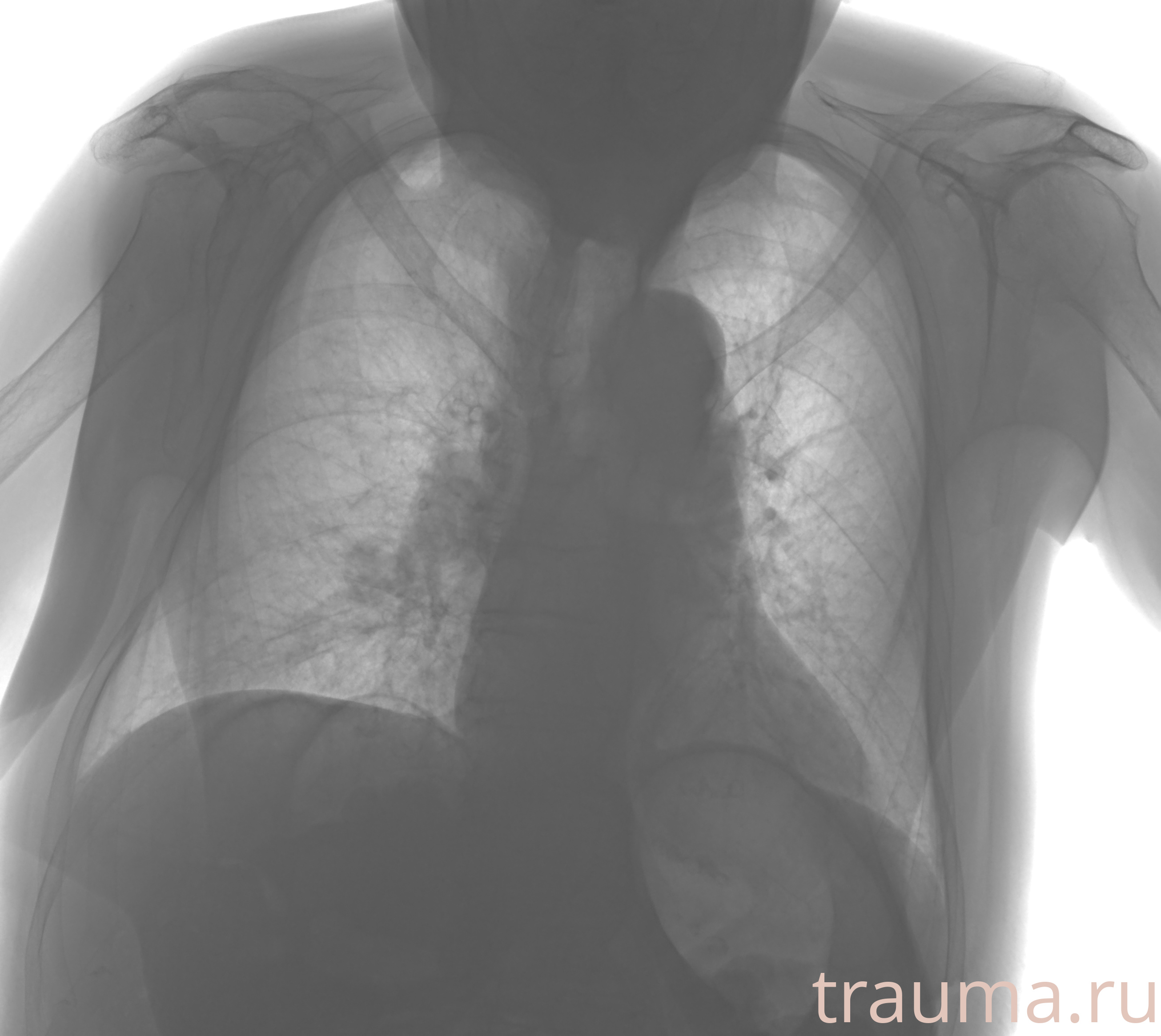 Рентген на дому: по вашему адресу приезжает врач-рентгенолог, травматолог-ортопед с мобильным рентгеновским аппаратом, проводит диагностику травмы или заболевания, делает необходимые рентгенограммы, дает рекомендации по дальнейшему лечению. Получить качественные снимки в домашних условиях возможно благодаря уникальной методике, разработанной МосРентген Центром для института  Склифосовского