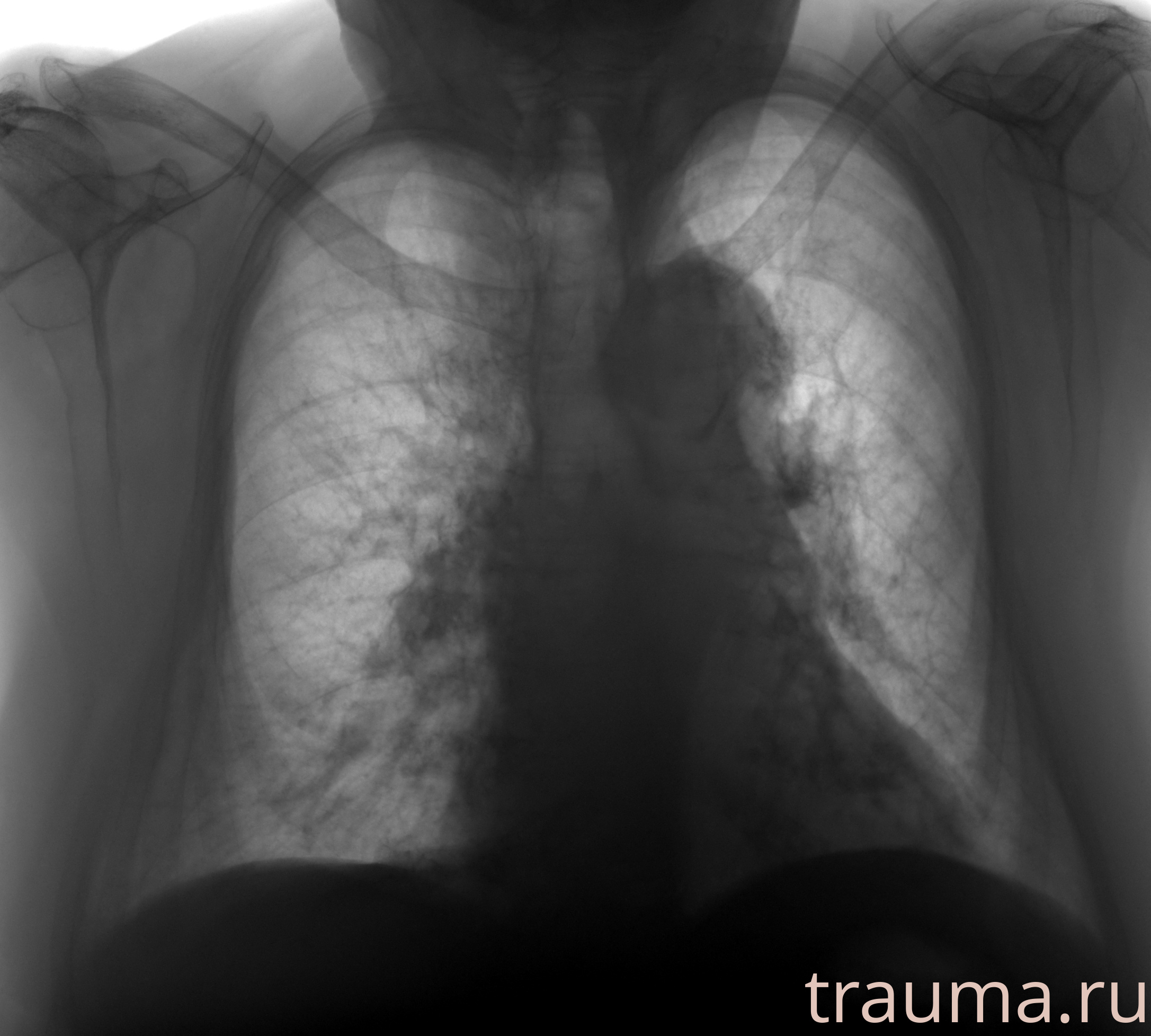 Рентген на дому: по вашему адресу приезжает врач-рентгенолог, травматолог-ортопед с мобильным рентгеновским аппаратом, проводит диагностику травмы или заболевания, делает необходимые рентгенограммы, дает рекомендации по дальнейшему лечению. Получить качественные снимки в домашних условиях возможно благодаря уникальной методике, разработанной МосРентген Центром для института  Склифосовского