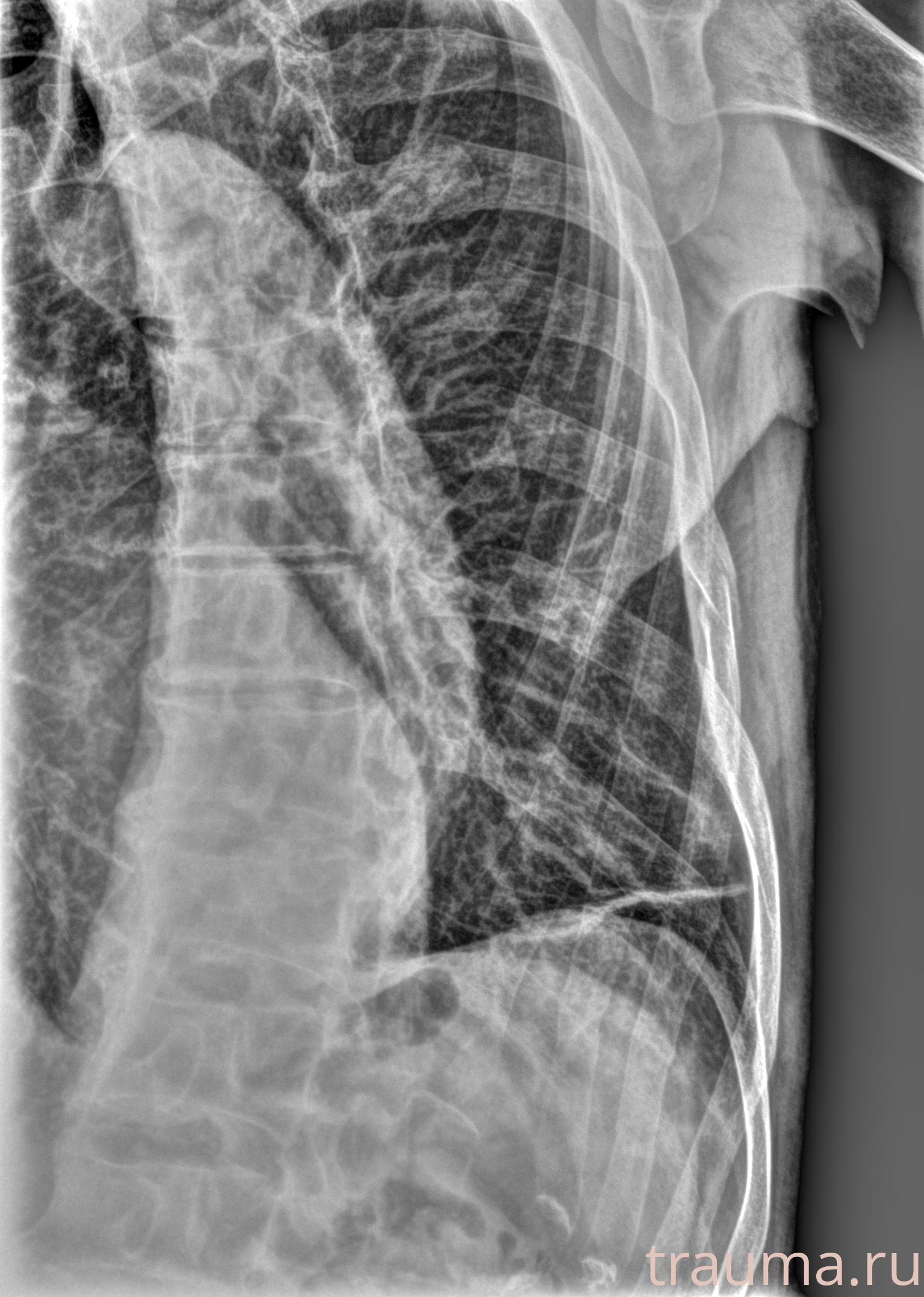 Рентген на дому: по вашему адресу приезжает врач-рентгенолог, травматолог-ортопед с мобильным рентгеновским аппаратом, проводит диагностику травмы или заболевания, делает необходимые рентгенограммы, дает рекомендации по дальнейшему лечению. Получить качественные снимки в домашних условиях возможно благодаря уникальной методике, разработанной МосРентген Центром для института  Склифосовского