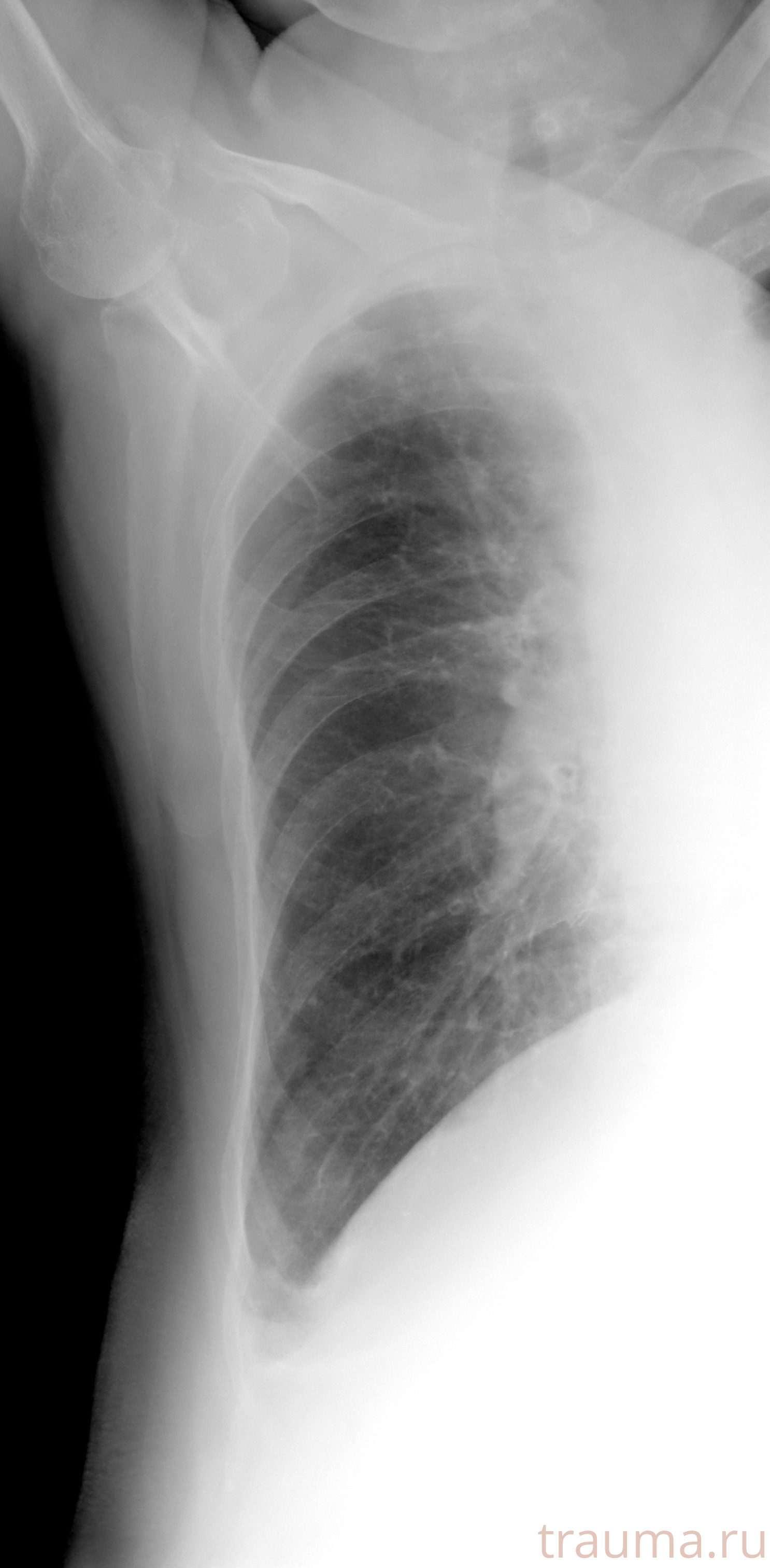 Рентген на дому: по вашему адресу приезжает врач-рентгенолог, травматолог-ортопед с мобильным рентгеновским аппаратом, проводит диагностику травмы или заболевания, делает необходимые рентгенограммы, дает рекомендации по дальнейшему лечению. Получить качественные снимки в домашних условиях возможно благодаря уникальной методике, разработанной МосРентген Центром для института  Склифосовского