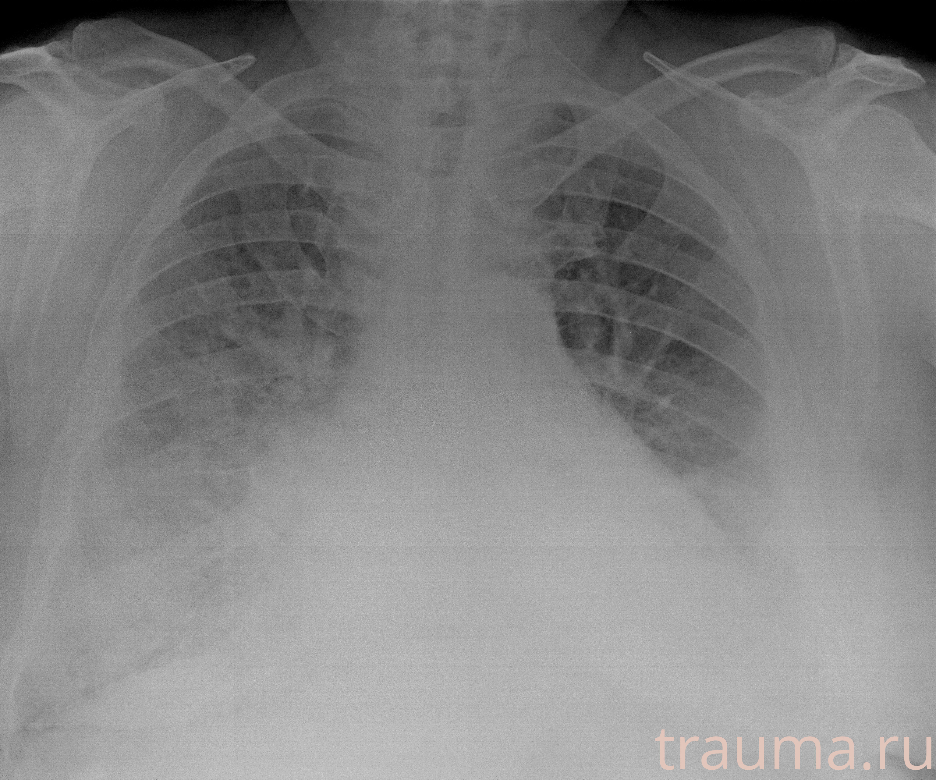 Рентген на дому: по вашему адресу приезжает врач-рентгенолог, травматолог-ортопед с мобильным рентгеновским аппаратом, проводит диагностику травмы или заболевания, делает необходимые рентгенограммы, дает рекомендации по дальнейшему лечению. Получить качественные снимки в домашних условиях возможно благодаря уникальной методике, разработанной МосРентген Центром для института  Склифосовского