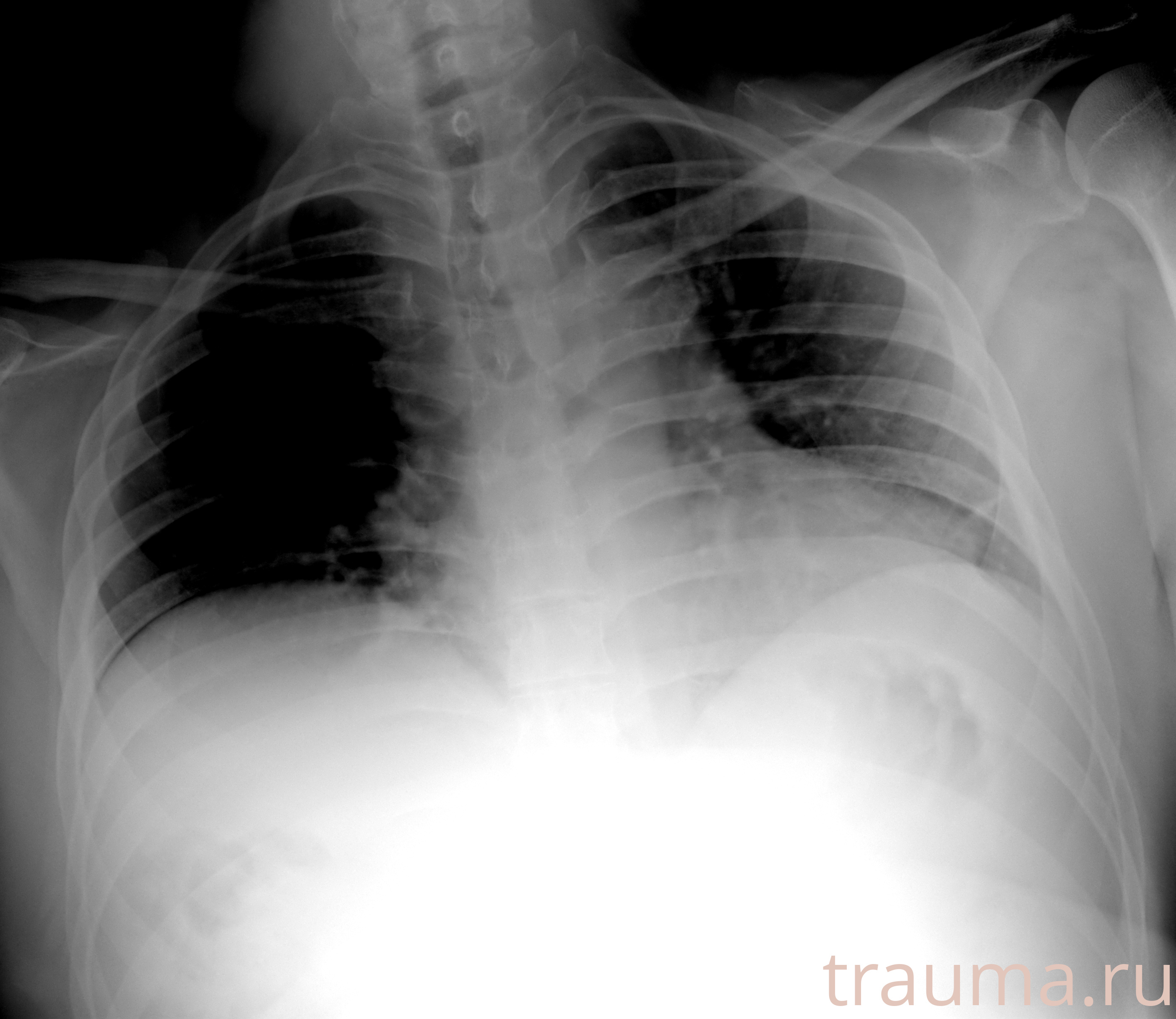 Рентген на дому: по вашему адресу приезжает врач-рентгенолог, травматолог-ортопед с мобильным рентгеновским аппаратом, проводит диагностику травмы или заболевания, делает необходимые рентгенограммы, дает рекомендации по дальнейшему лечению. Получить качественные снимки в домашних условиях возможно благодаря уникальной методике, разработанной МосРентген Центром для института  Склифосовского