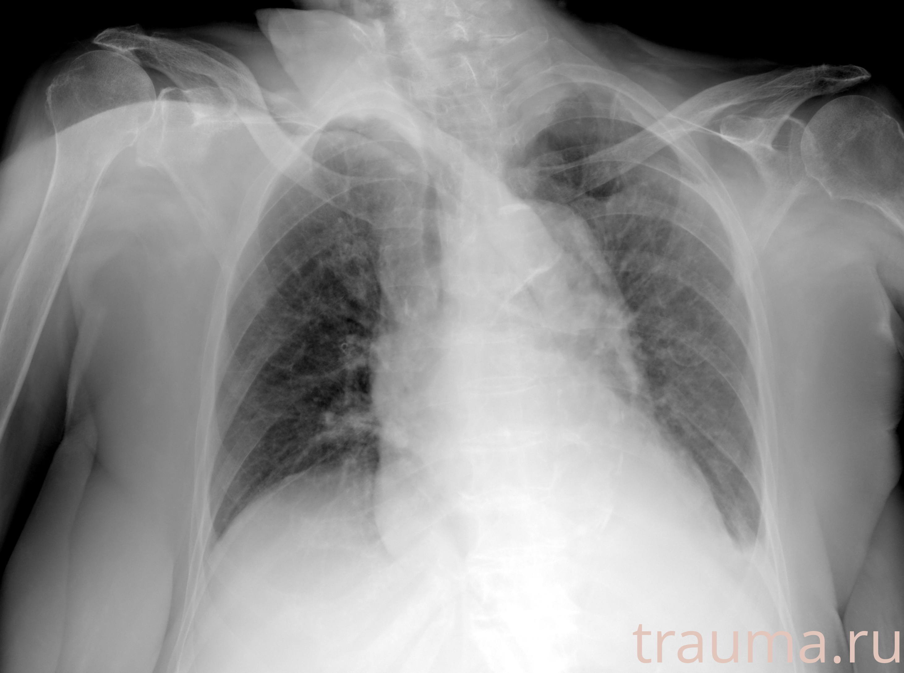 Рентген на дому: по вашему адресу приезжает врач-рентгенолог, травматолог-ортопед с мобильным рентгеновским аппаратом, проводит диагностику травмы или заболевания, делает необходимые рентгенограммы, дает рекомендации по дальнейшему лечению. Получить качественные снимки в домашних условиях возможно благодаря уникальной методике, разработанной МосРентген Центром для института  Склифосовского