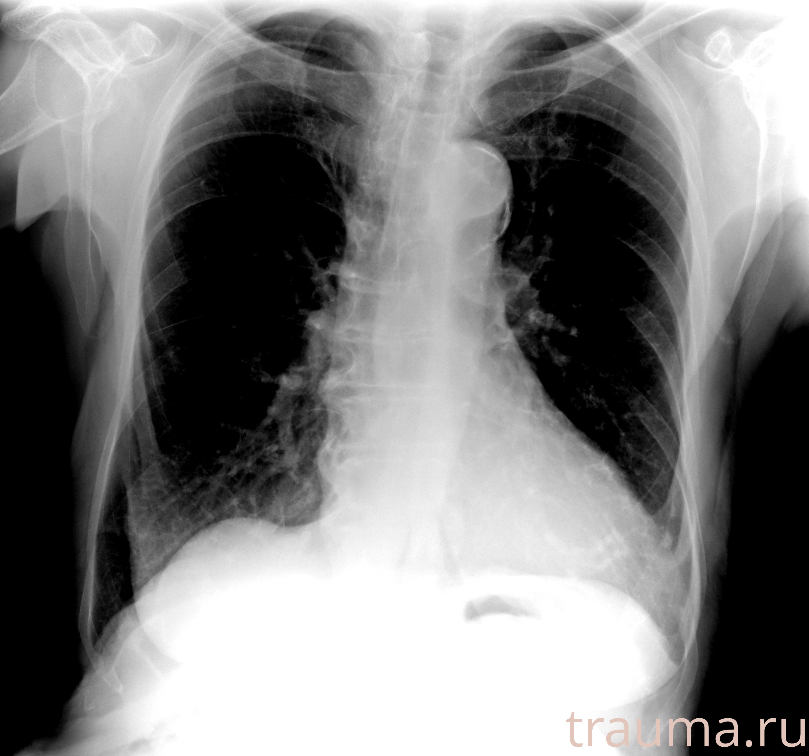 Рентген на дому: по вашему адресу приезжает врач-рентгенолог, травматолог-ортопед с мобильным рентгеновским аппаратом, проводит диагностику травмы или заболевания, делает необходимые рентгенограммы, дает рекомендации по дальнейшему лечению. Получить качественные снимки в домашних условиях возможно благодаря уникальной методике, разработанной МосРентген Центром для института  Склифосовского