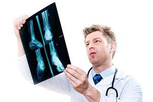 Классификация подвывихов таранной кости  при повреждениях голеностопного сустава
