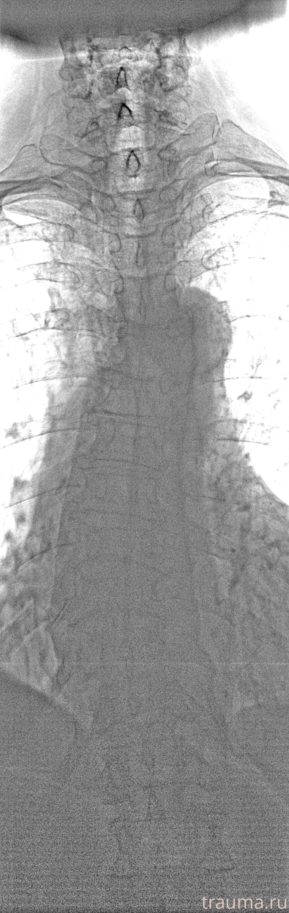 Рентген на дому: по вашему адресу приезжает врач-рентгенолог, травматолог-ортопед с мобильным рентгеновским аппаратом, проводит диагностику травмы или заболевания, делает необходимые рентгенограммы, дает рекомендации по дальнейшему лечению. Получить качественные снимки в домашних условиях возможно благодаря уникальной методике, разработанной МосРентген Центром для института  Склифосовского