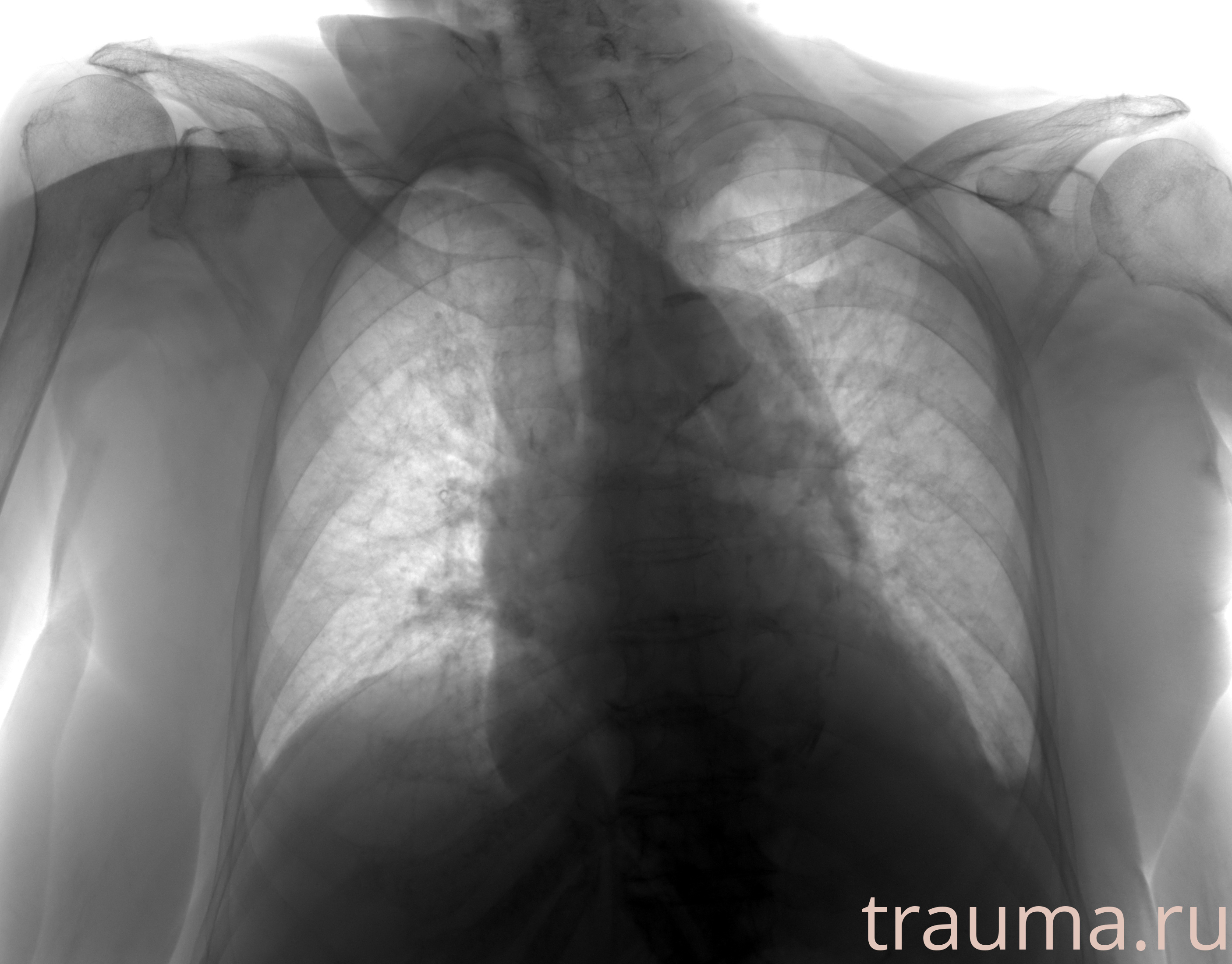 Рентген на дому: по вашему адресу приезжает врач-рентгенолог, травматолог-ортопед с мобильным рентгеновским аппаратом, проводит диагностику травмы или заболевания, делает необходимые рентгенограммы, дает рекомендации по дальнейшему лечению. Получить качественные снимки в домашних условиях возможно благодаря уникальной методике, разработанной МосРентген Центром для института  Склифосовского