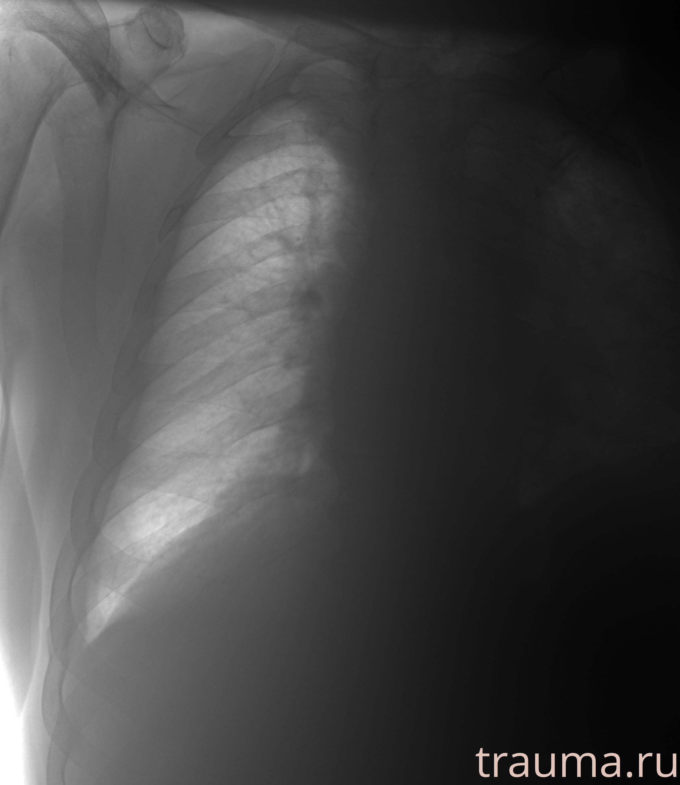 Рентген на дому: по вашему адресу приезжает врач-рентгенолог, травматолог-ортопед с мобильным рентгеновским аппаратом, проводит диагностику травмы или заболевания, делает необходимые рентгенограммы, дает рекомендации по дальнейшему лечению. Получить качественные снимки в домашних условиях возможно благодаря уникальной методике, разработанной МосРентген Центром для института  Склифосовского