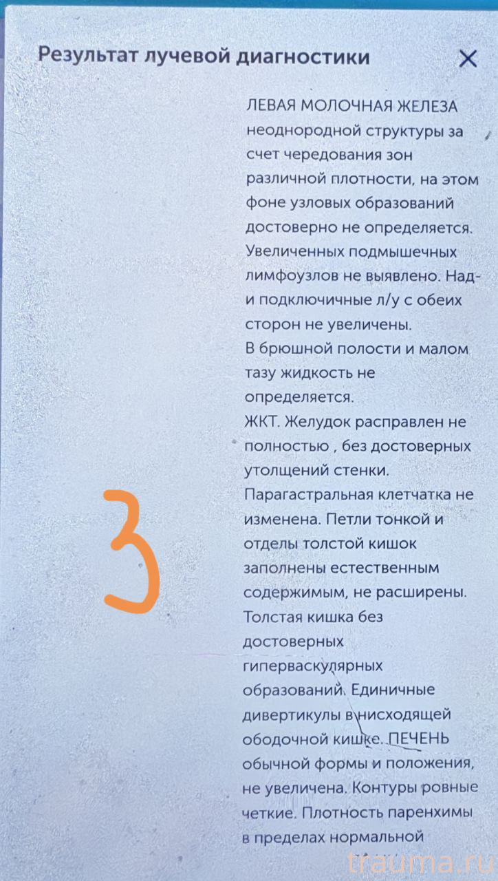 Рентген на дому: по вашему адресу приезжает врач-рентгенолог, травматолог-ортопед с мобильным рентгеновским аппаратом, проводит диагностику травмы или заболевания, делает необходимые рентгенограммы, дает рекомендации по дальнейшему лечению. Получить качественные снимки в домашних условиях возможно благодаря уникальной методике, разработанной МосРентген Центром для института  Склифосовского