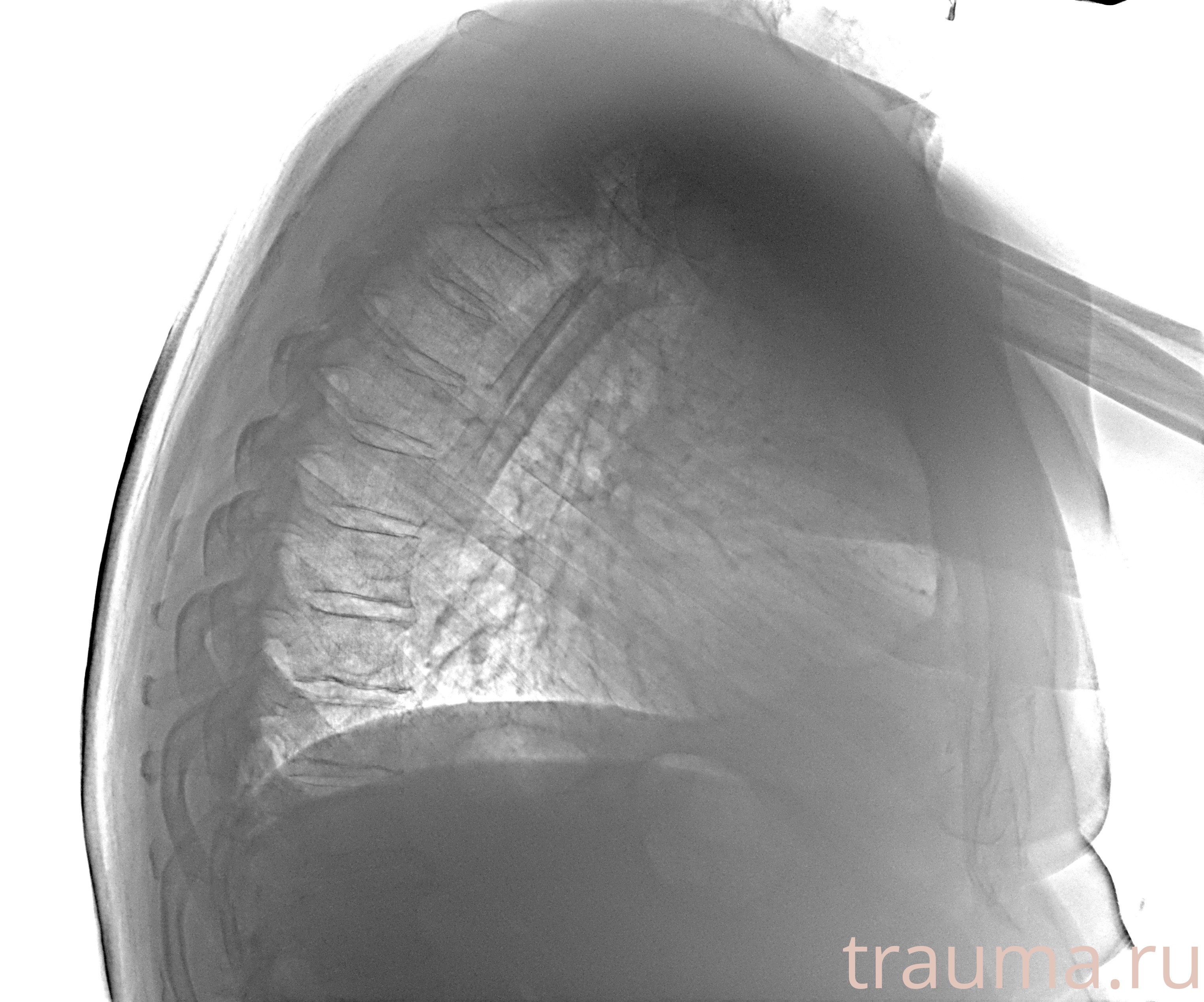 Рентген на дому: по вашему адресу приезжает врач-рентгенолог, травматолог-ортопед с мобильным рентгеновским аппаратом, проводит диагностику травмы или заболевания, делает необходимые рентгенограммы, дает рекомендации по дальнейшему лечению. Получить качественные снимки в домашних условиях возможно благодаря уникальной методике, разработанной МосРентген Центром для института  Склифосовского