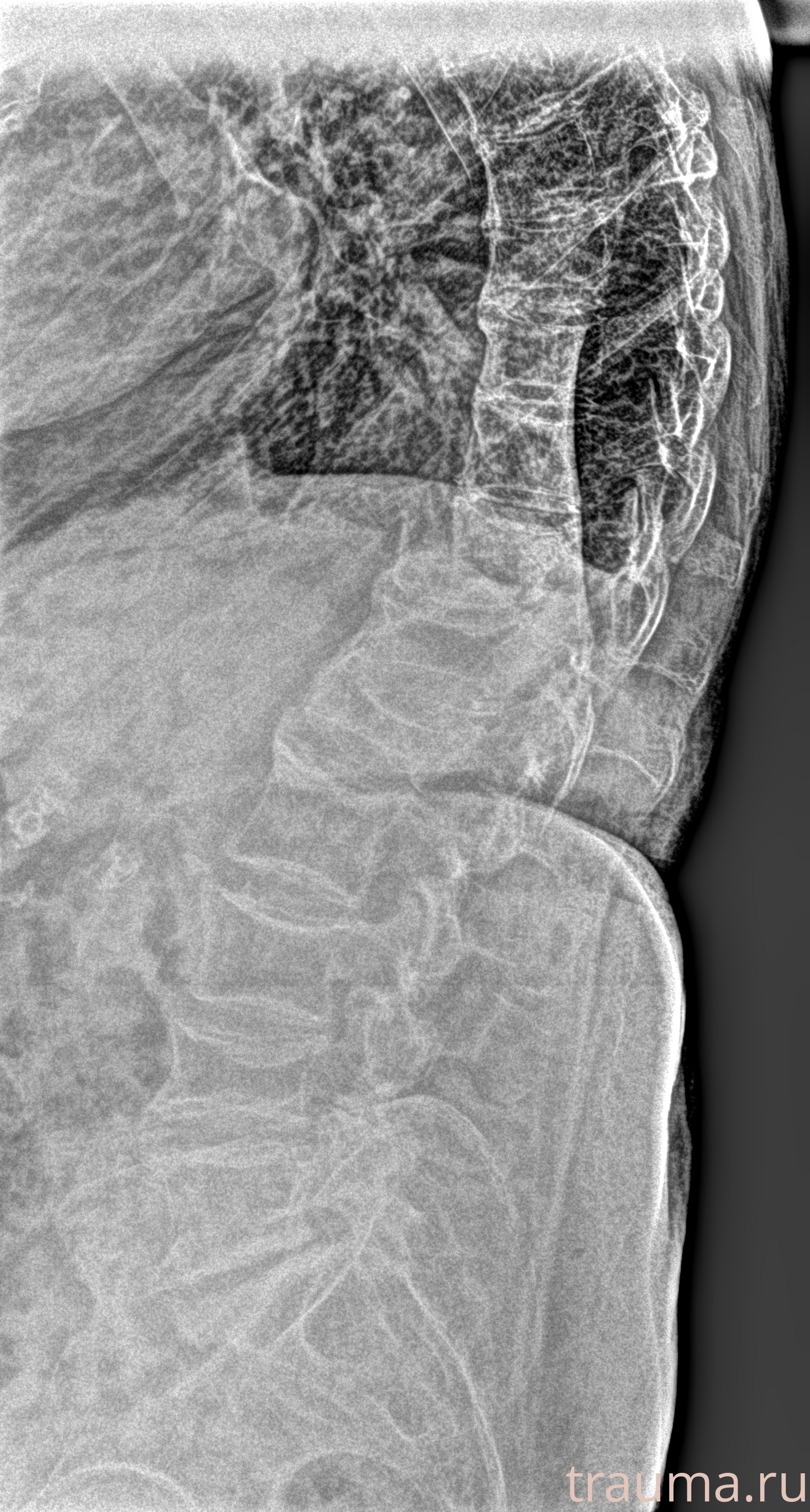 Рентген на дому: по вашему адресу приезжает врач-рентгенолог, травматолог-ортопед с мобильным рентгеновским аппаратом, проводит диагностику травмы или заболевания, делает необходимые рентгенограммы, дает рекомендации по дальнейшему лечению. Получить качественные снимки в домашних условиях возможно благодаря уникальной методике, разработанной МосРентген Центром для института  Склифосовского